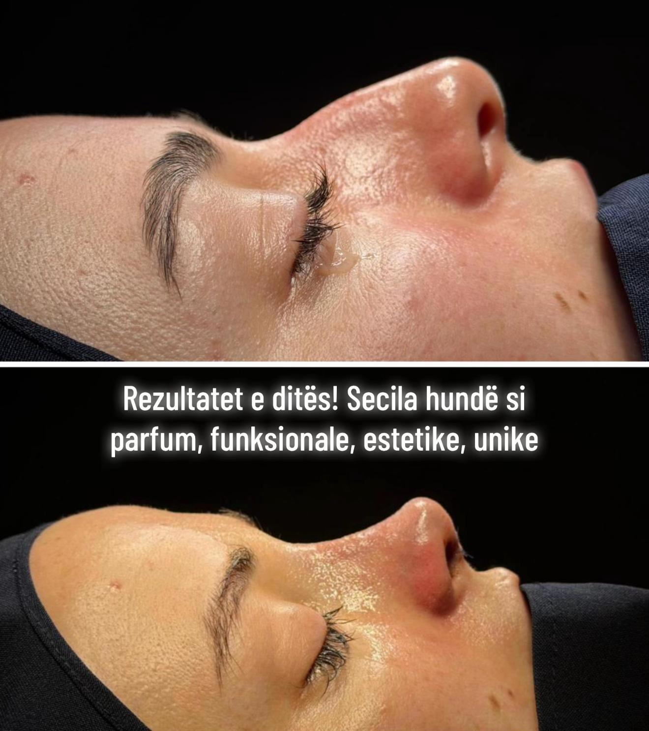@rinoplasticatirana