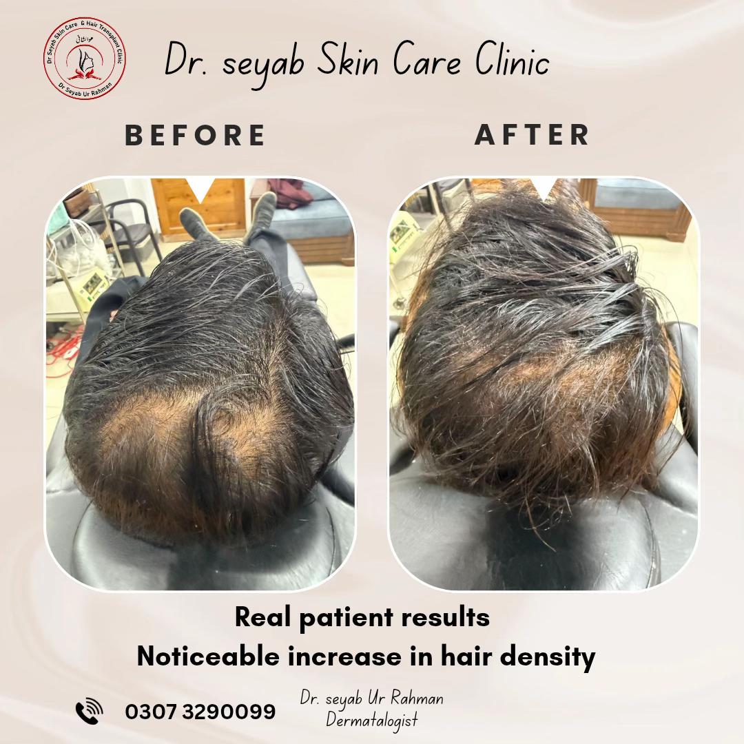 @Dr seyab Dermatologist