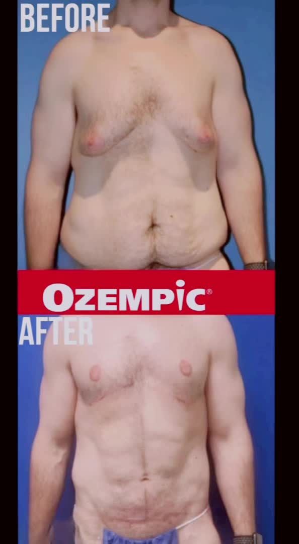 @mensplasticsurgery