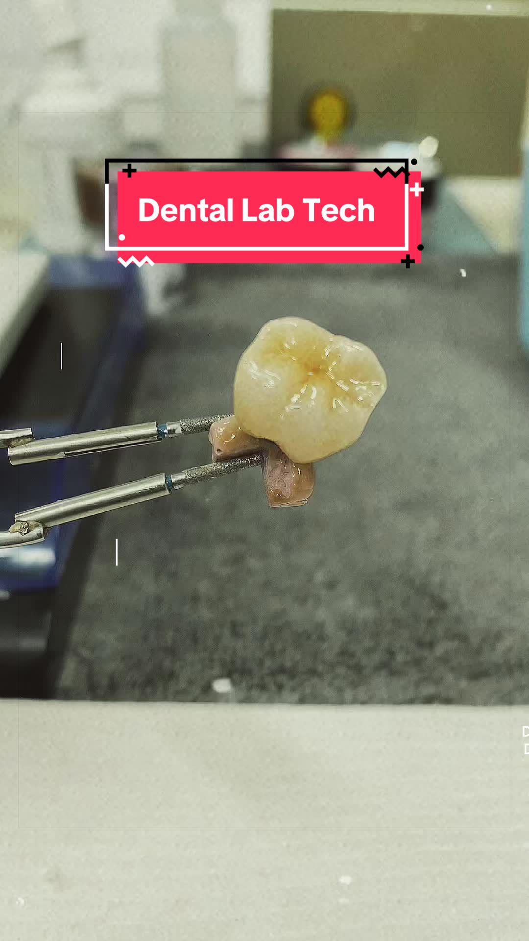 @Dental Tech Hey Jey