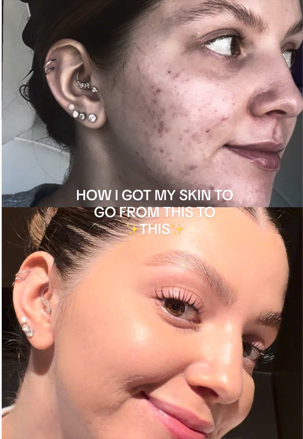 @skinbysyerra