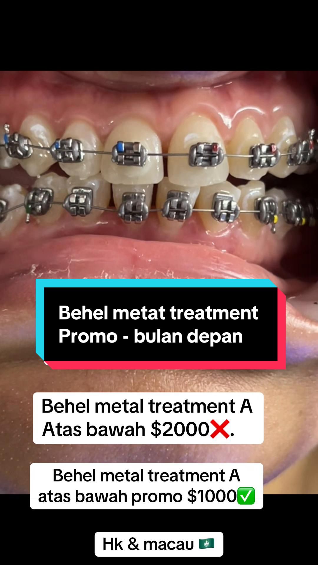 @mbak-Paijem