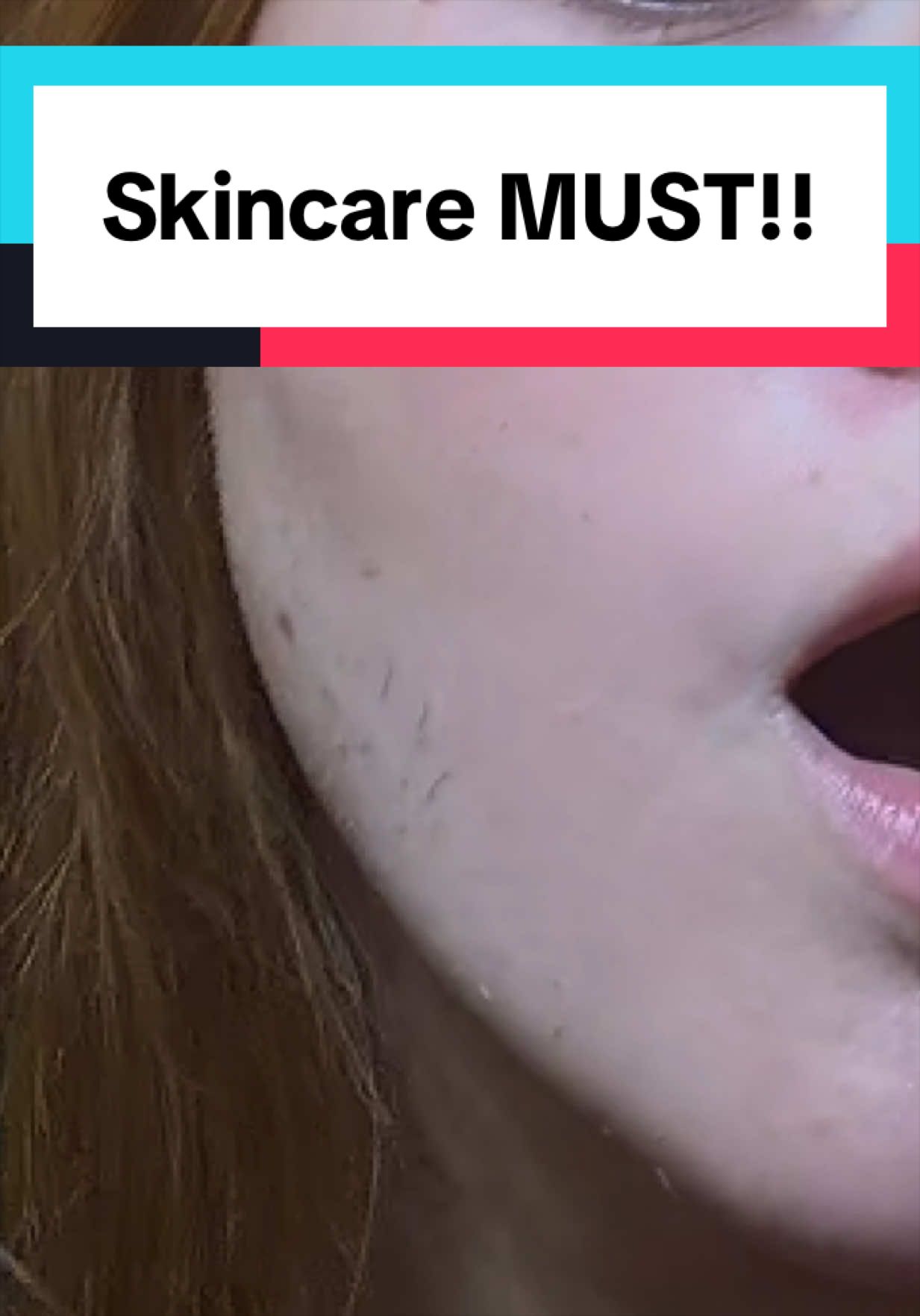 @miseon