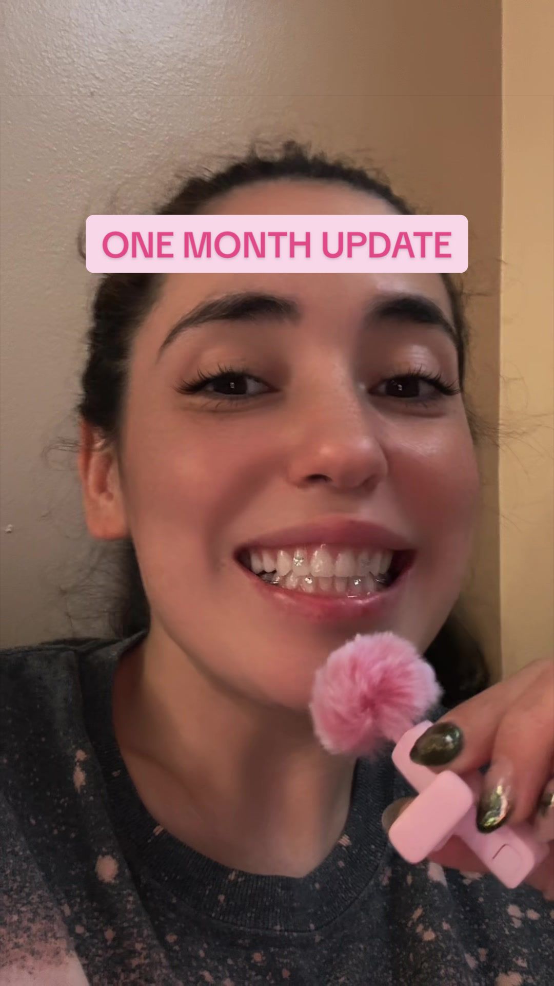 @Kiama 🎀💗🦷