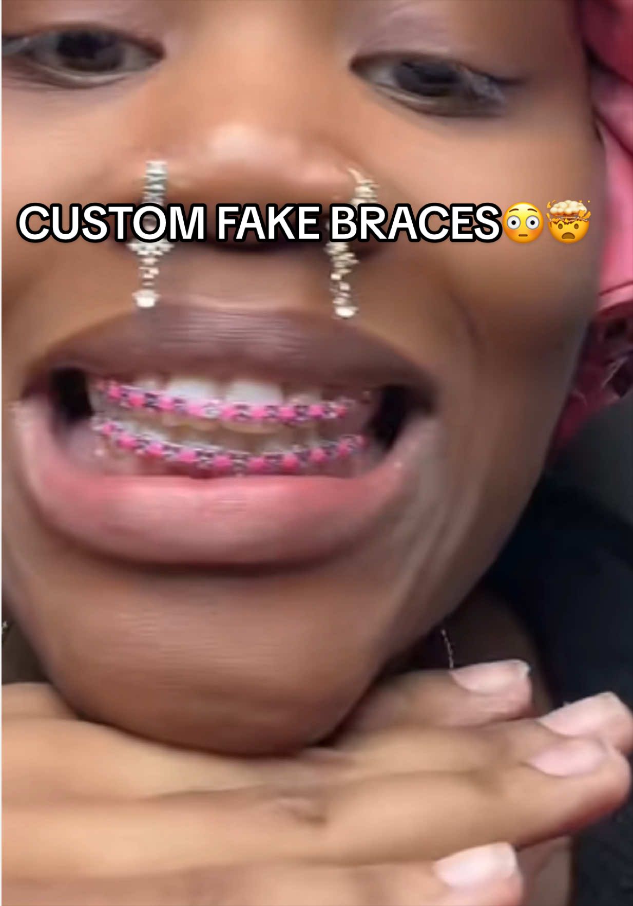 @Princessbracesplug🫶🏽🫆