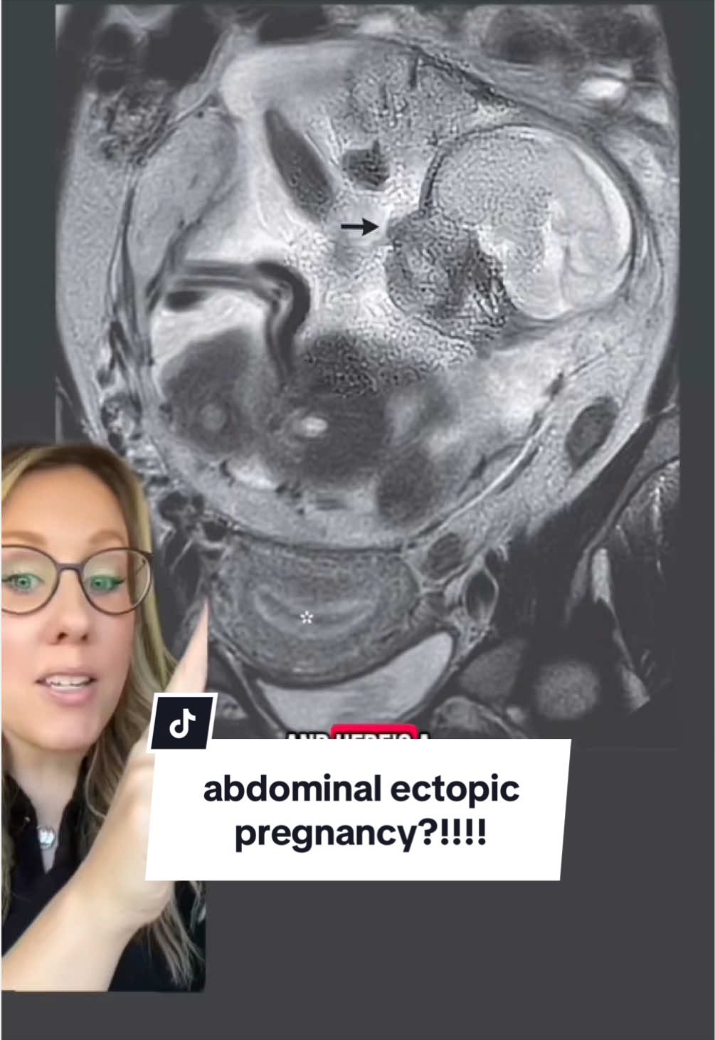 @Paging Dr. Fran