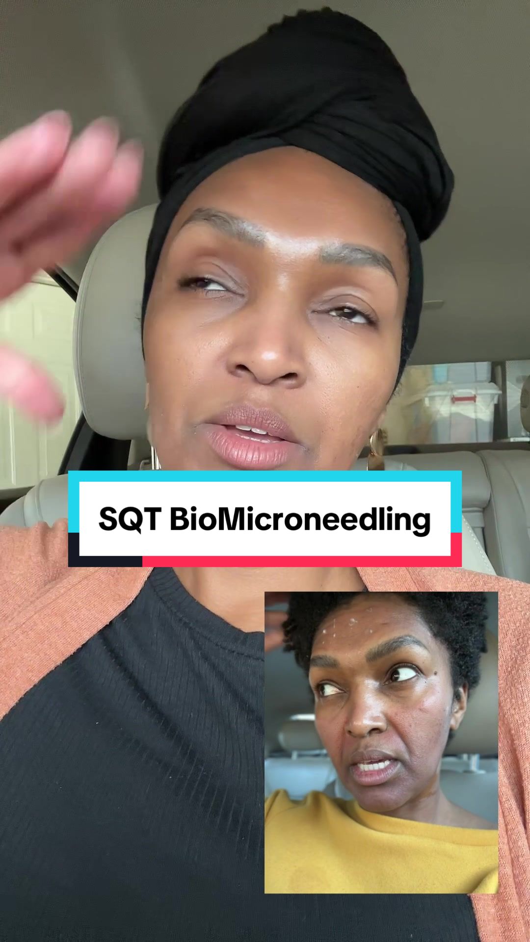 @Nina Webster✨Beauty+Skin Tech