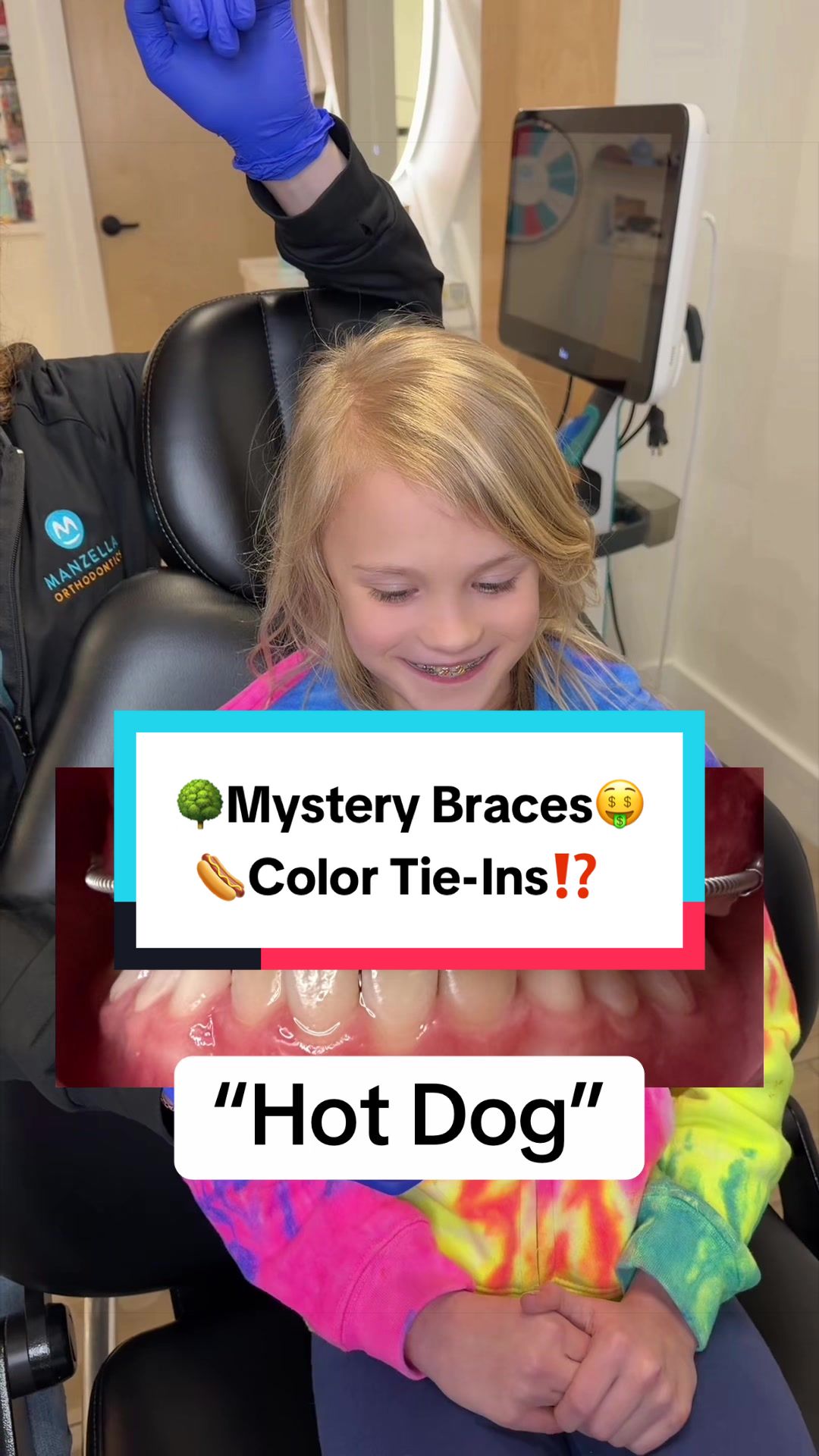 @Braces Survival Guide