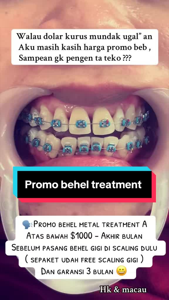 @mbak-Paijem