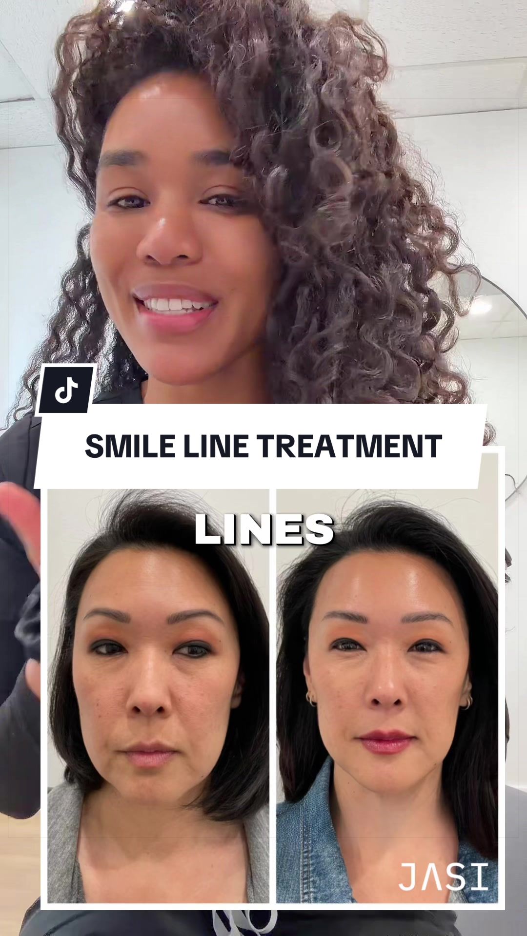 @Botox Filler Skin Los Angeles