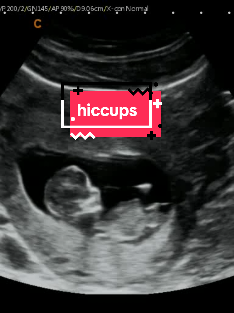 @Hey, Baby!