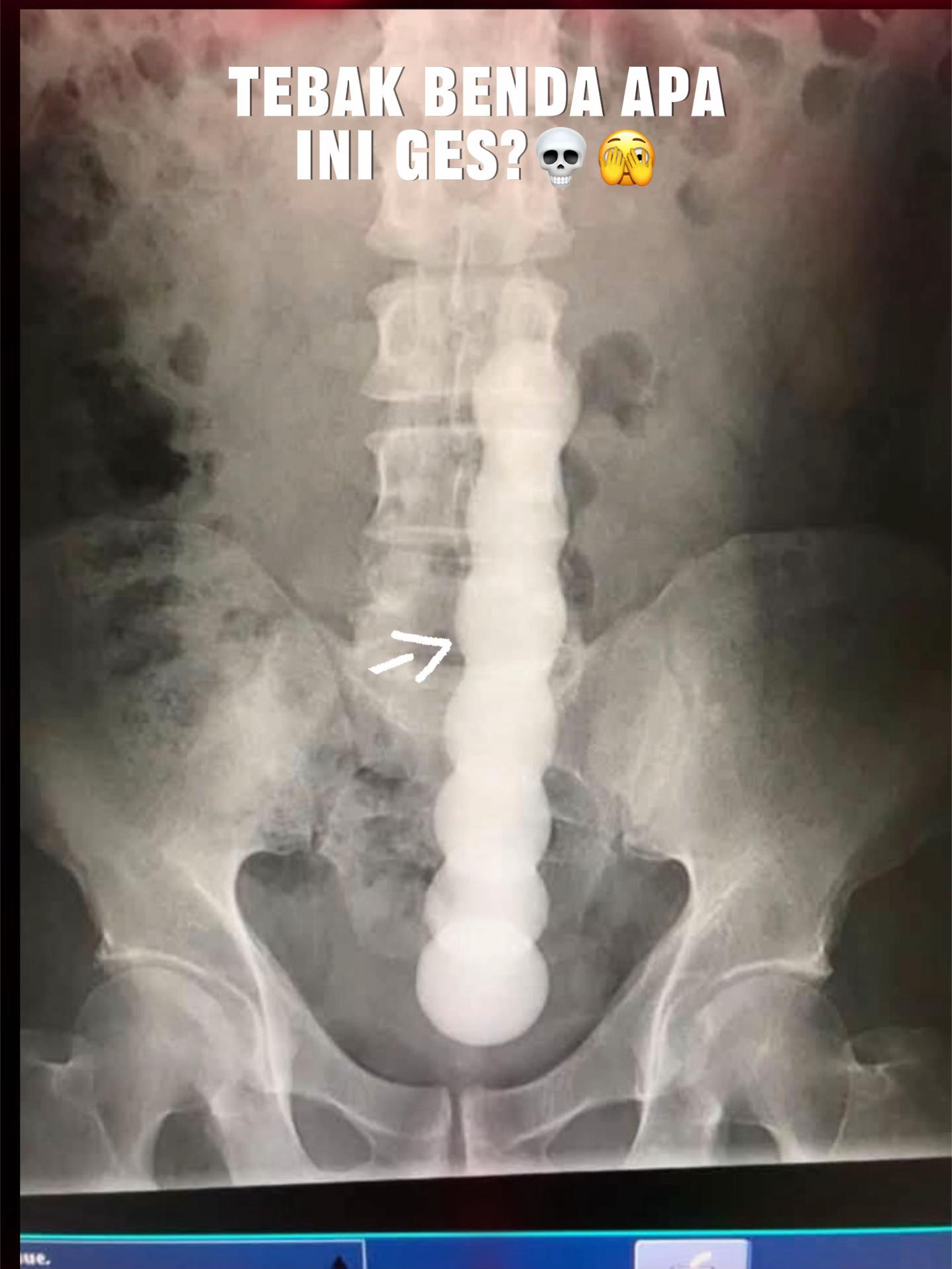 @Sobat Radiology