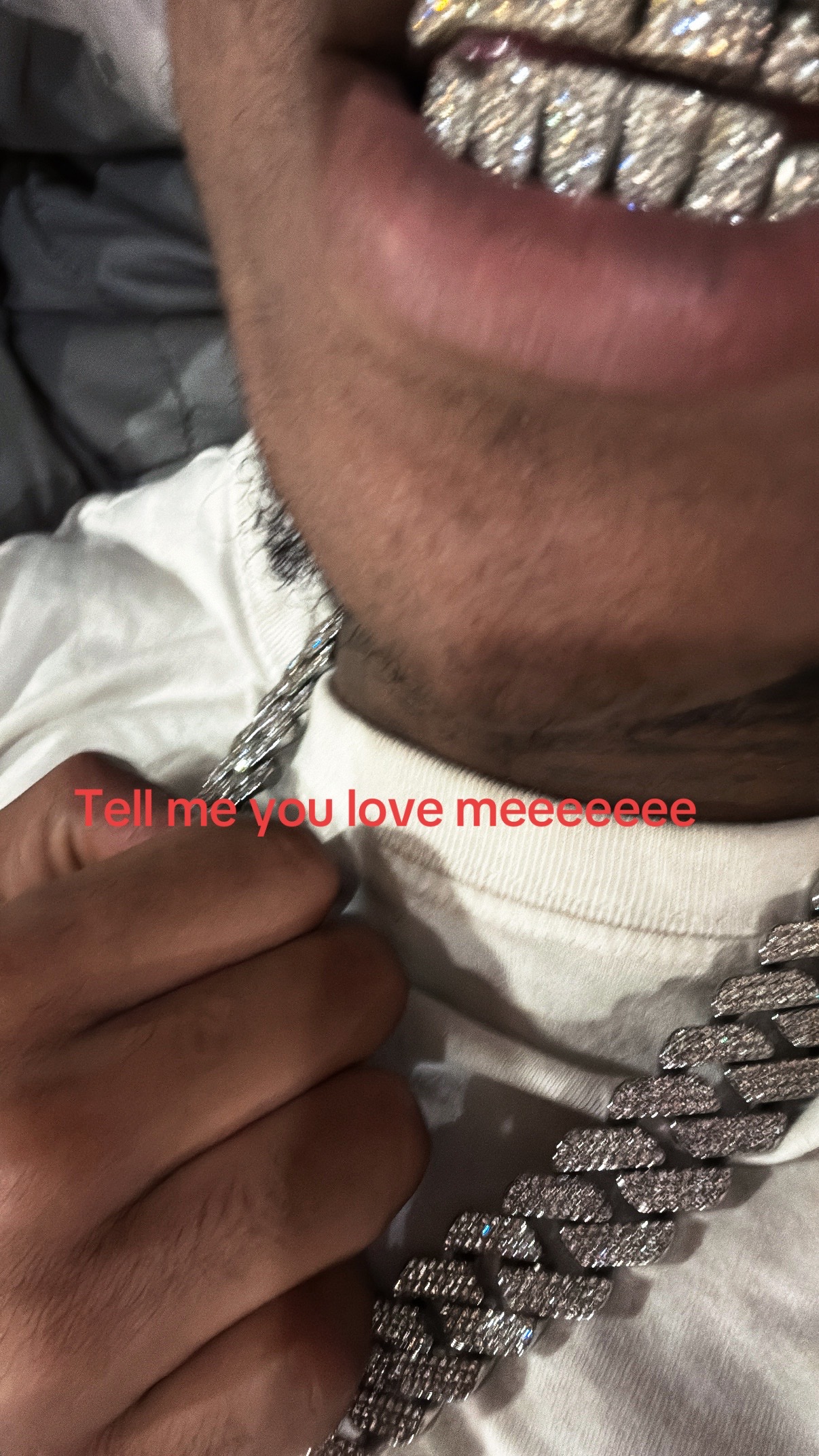 @TOP3