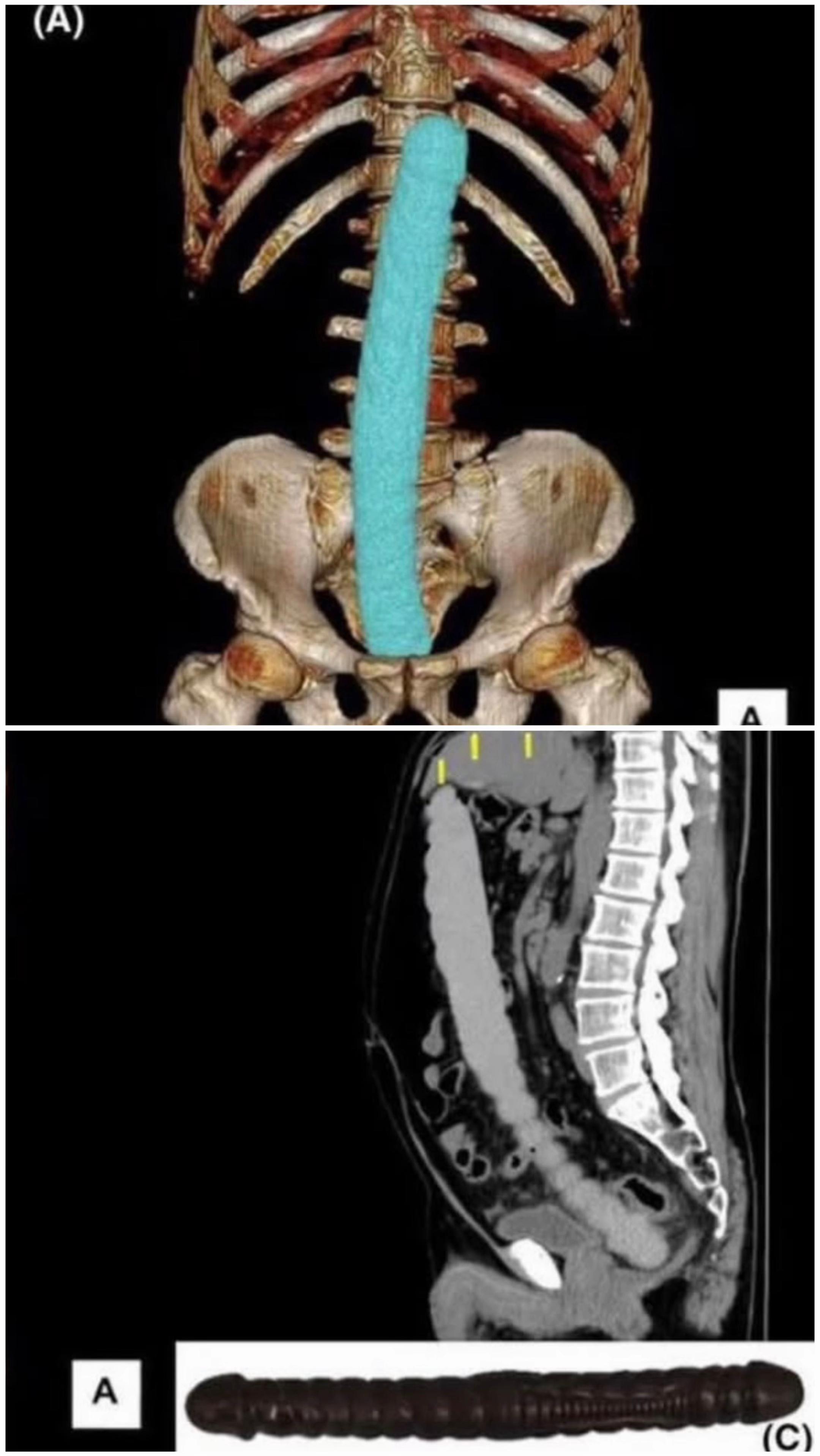 @Anatomie