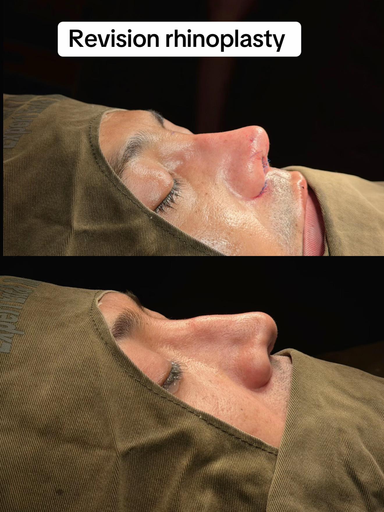 @Dr Ibrar ENT & Rhinoplasty