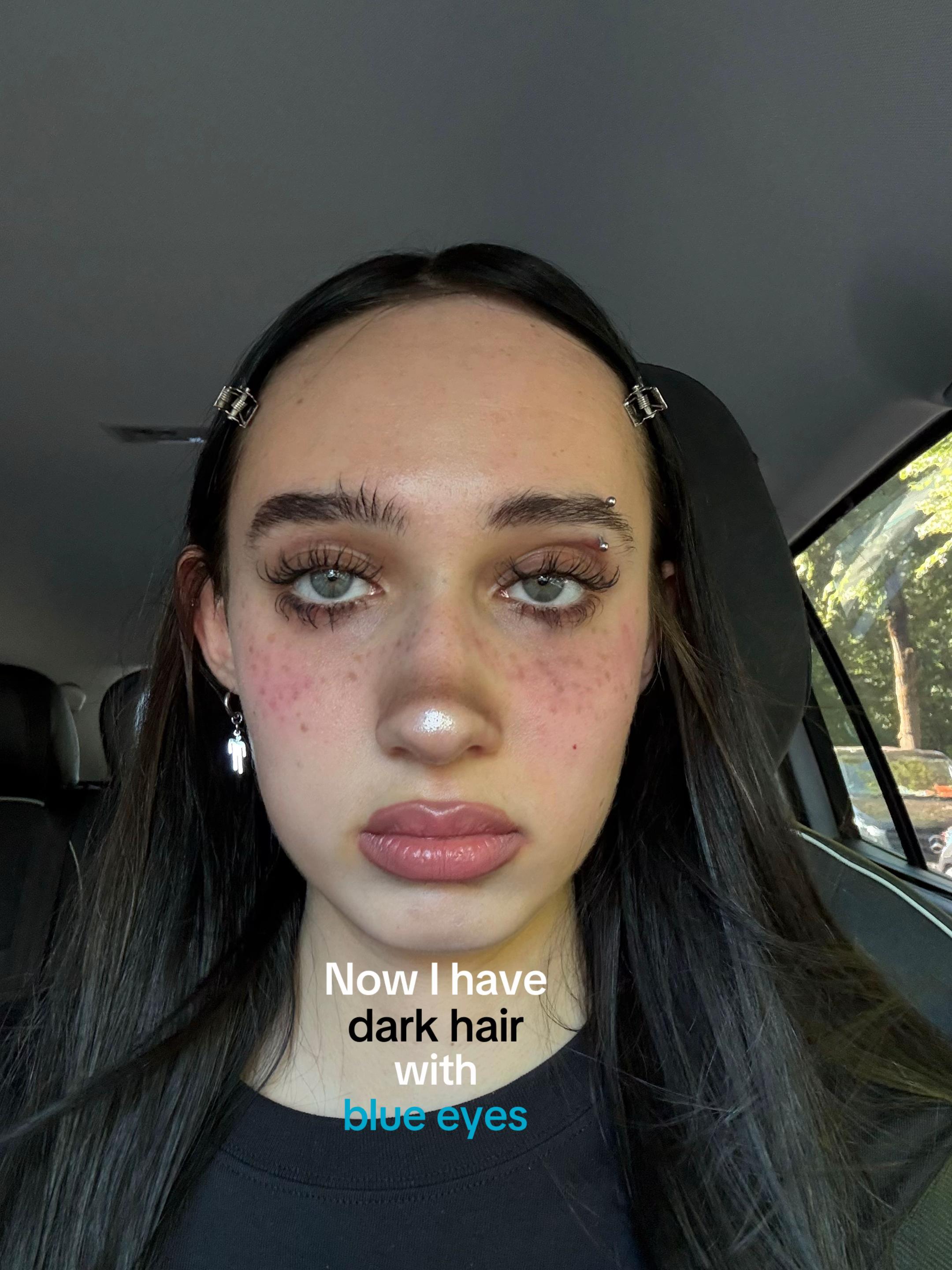 @๐ฉ