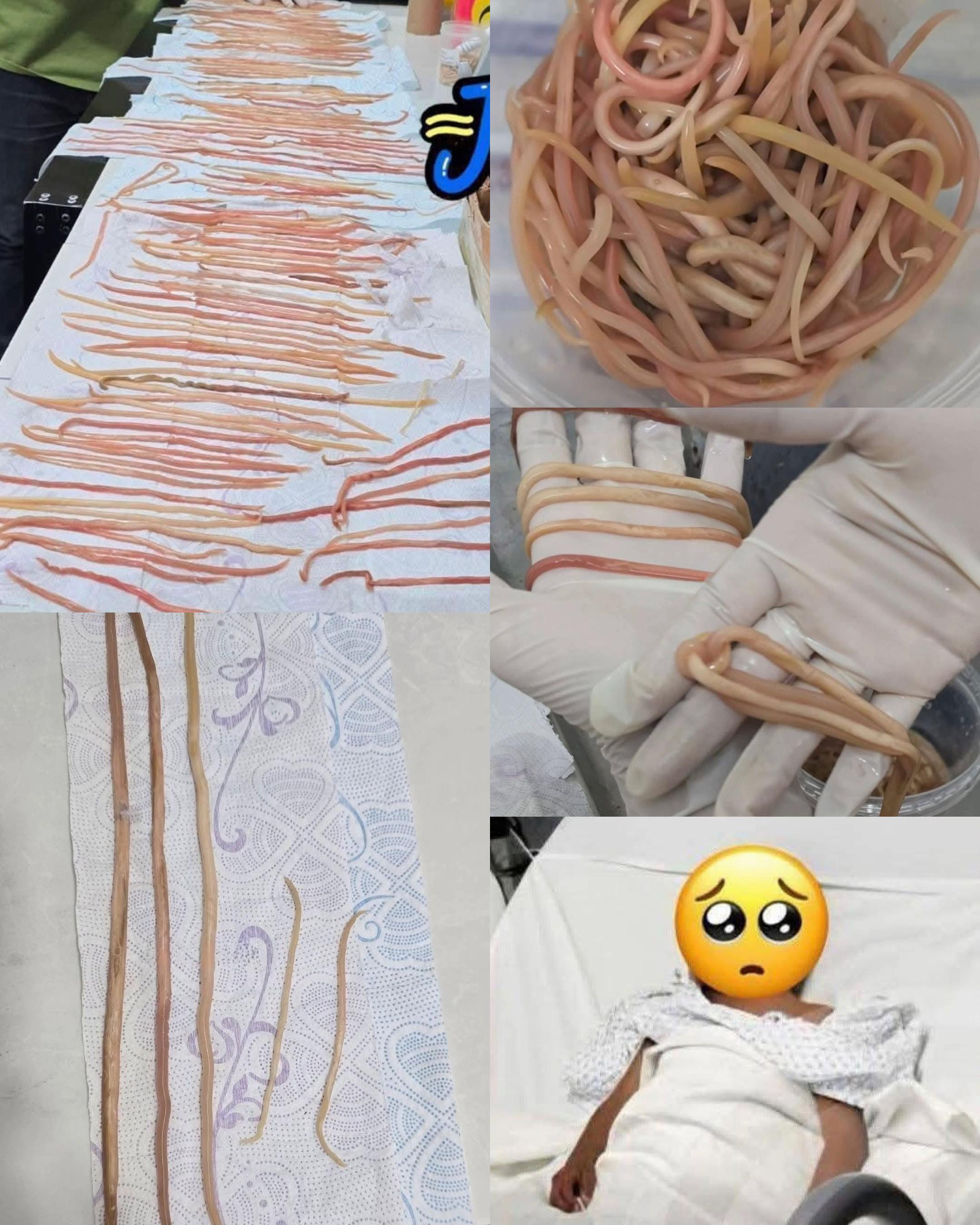 @Anatomie