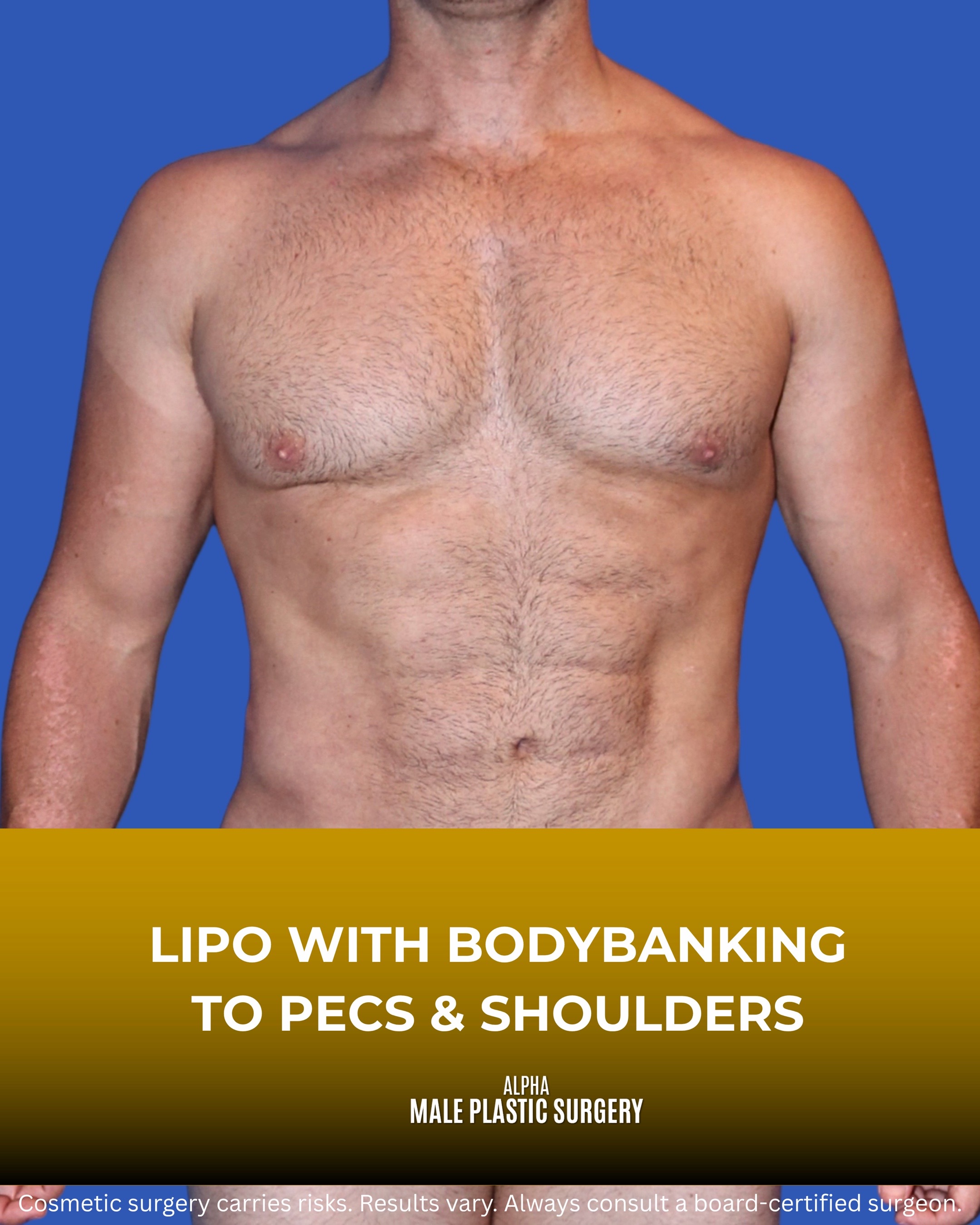 @mensplasticsurgery