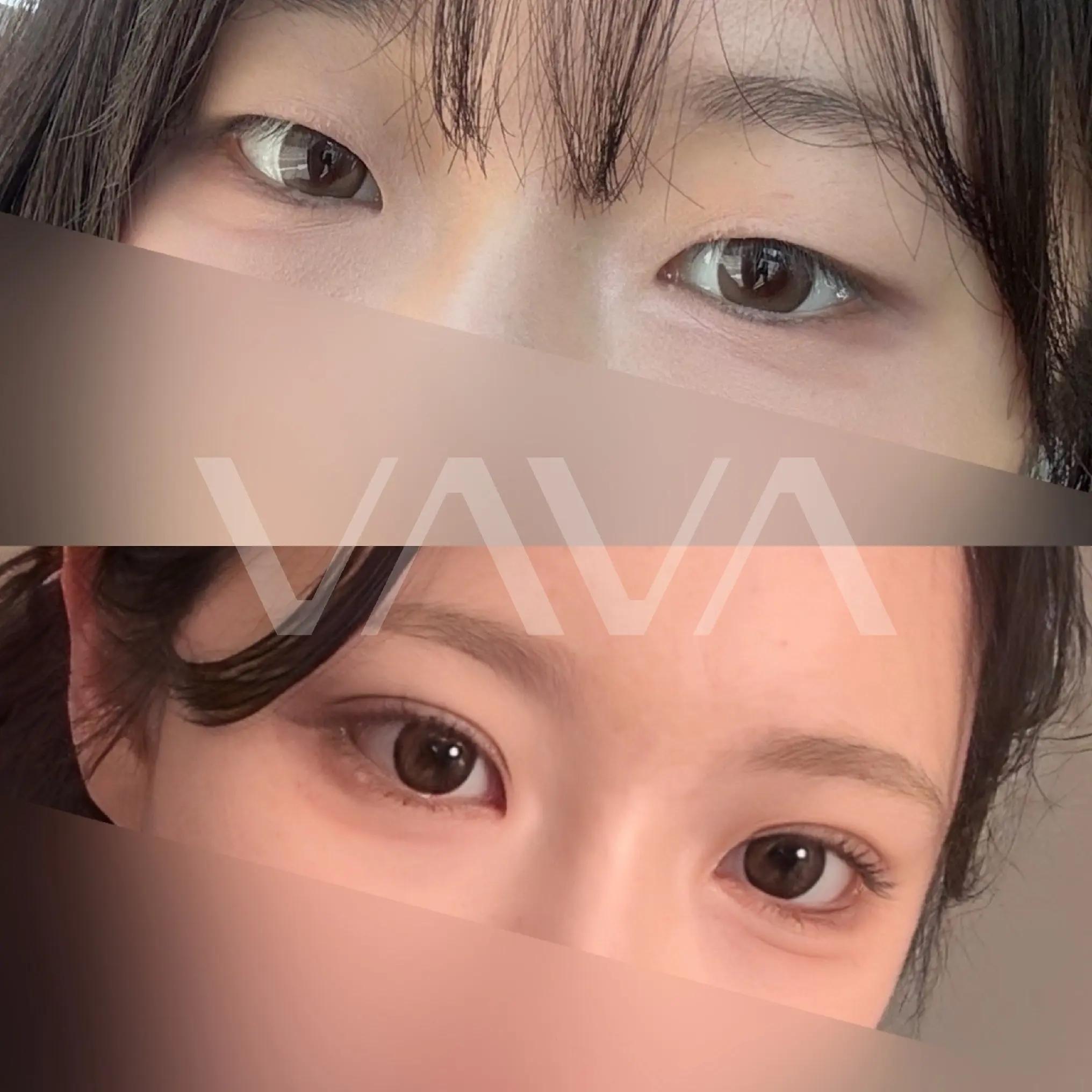 @VAVA美容整形外科