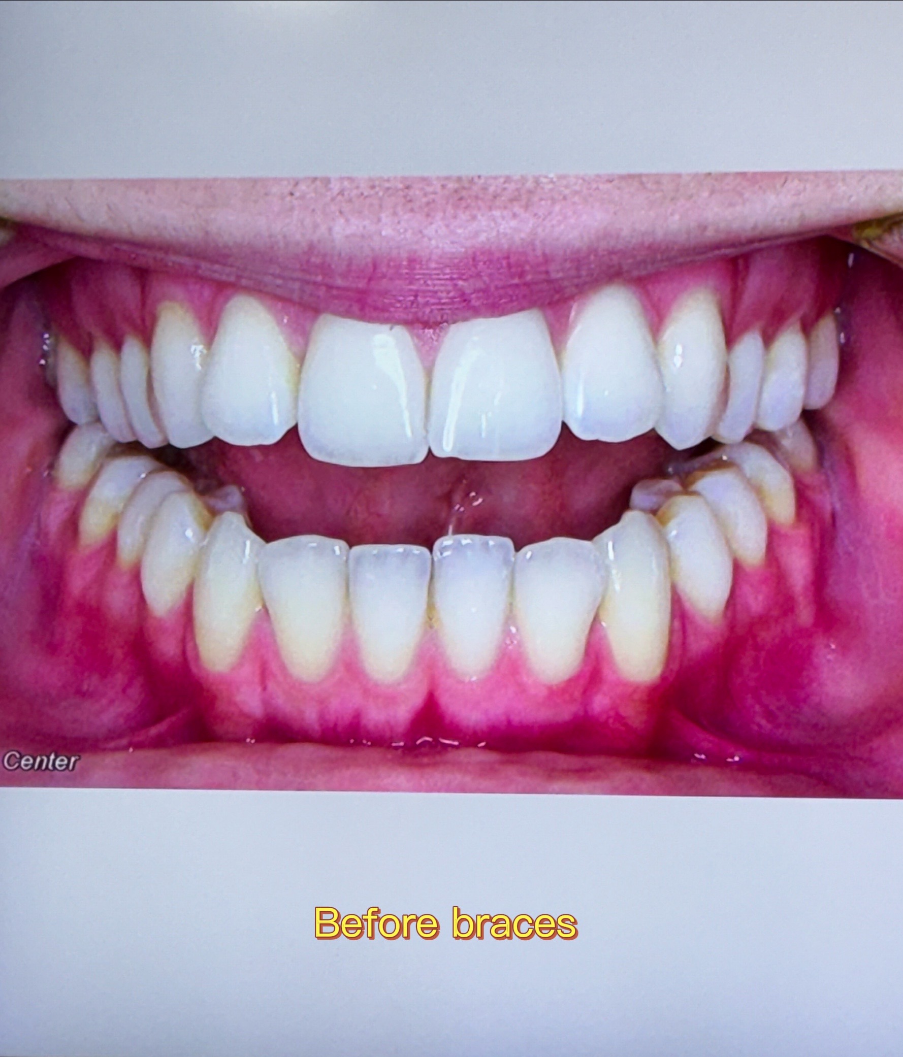 @Woodland Hills Orthodontist