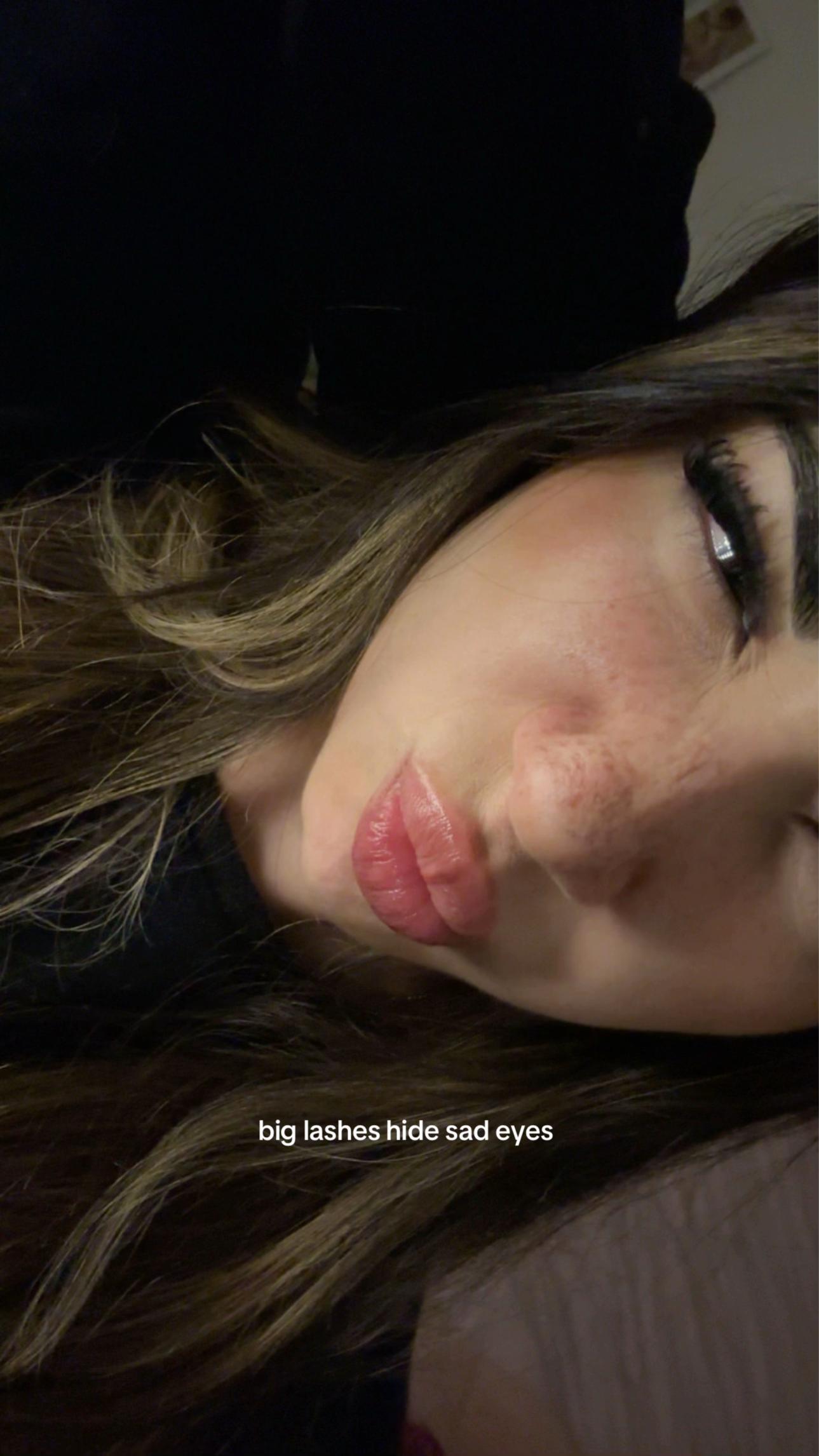 @complessata