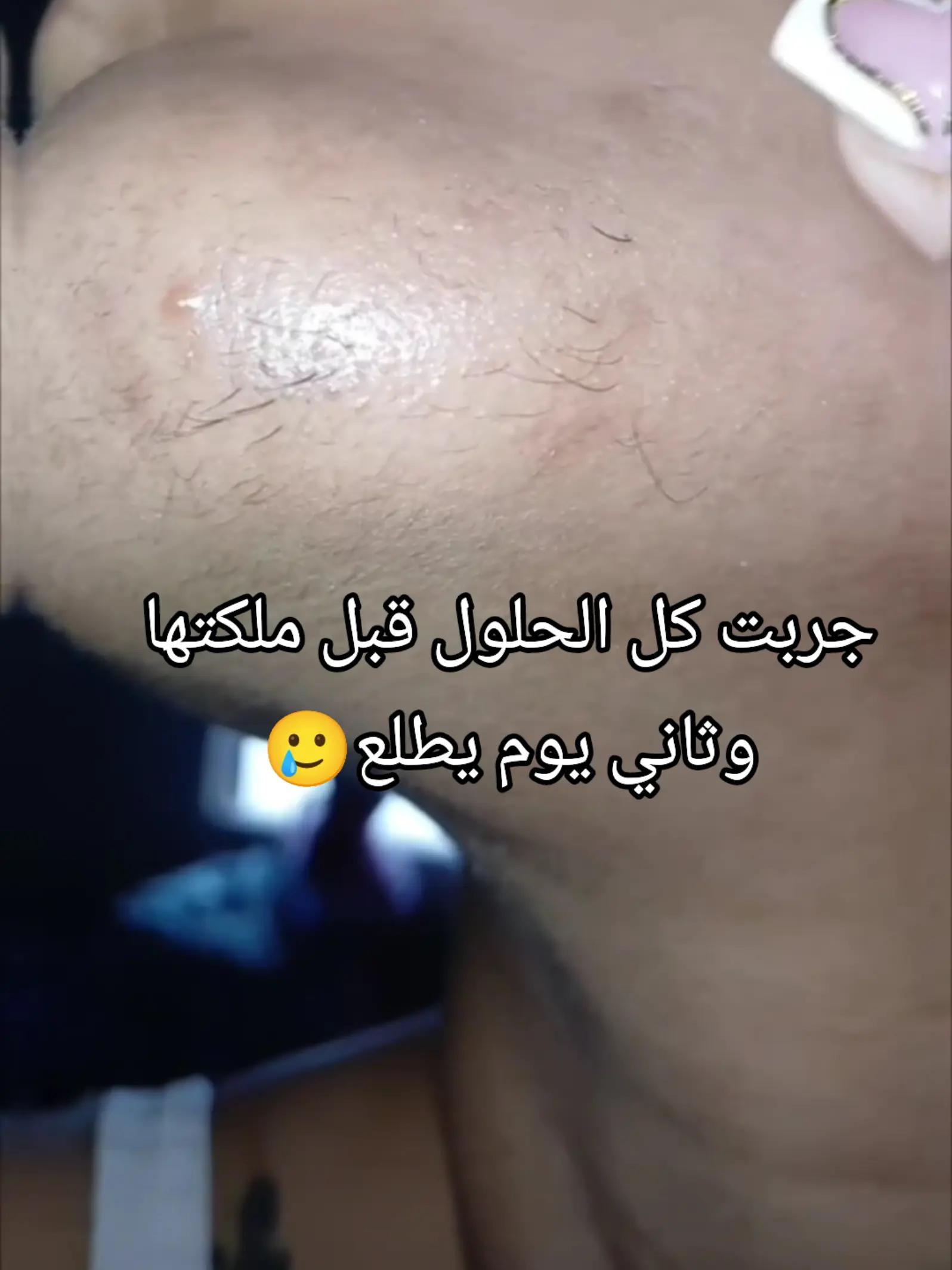 @أسرار الجمال مع ام سعود🎀