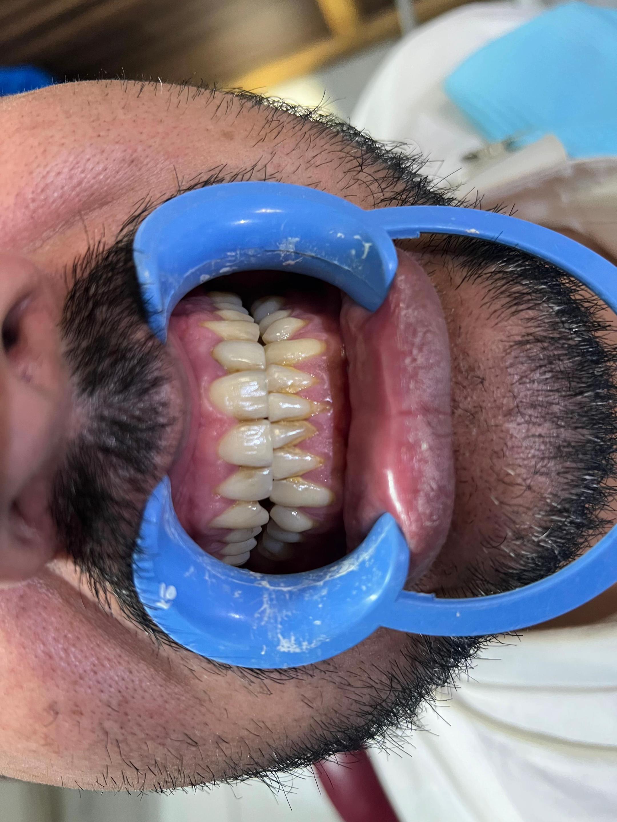 @DR Bilal Official🦷