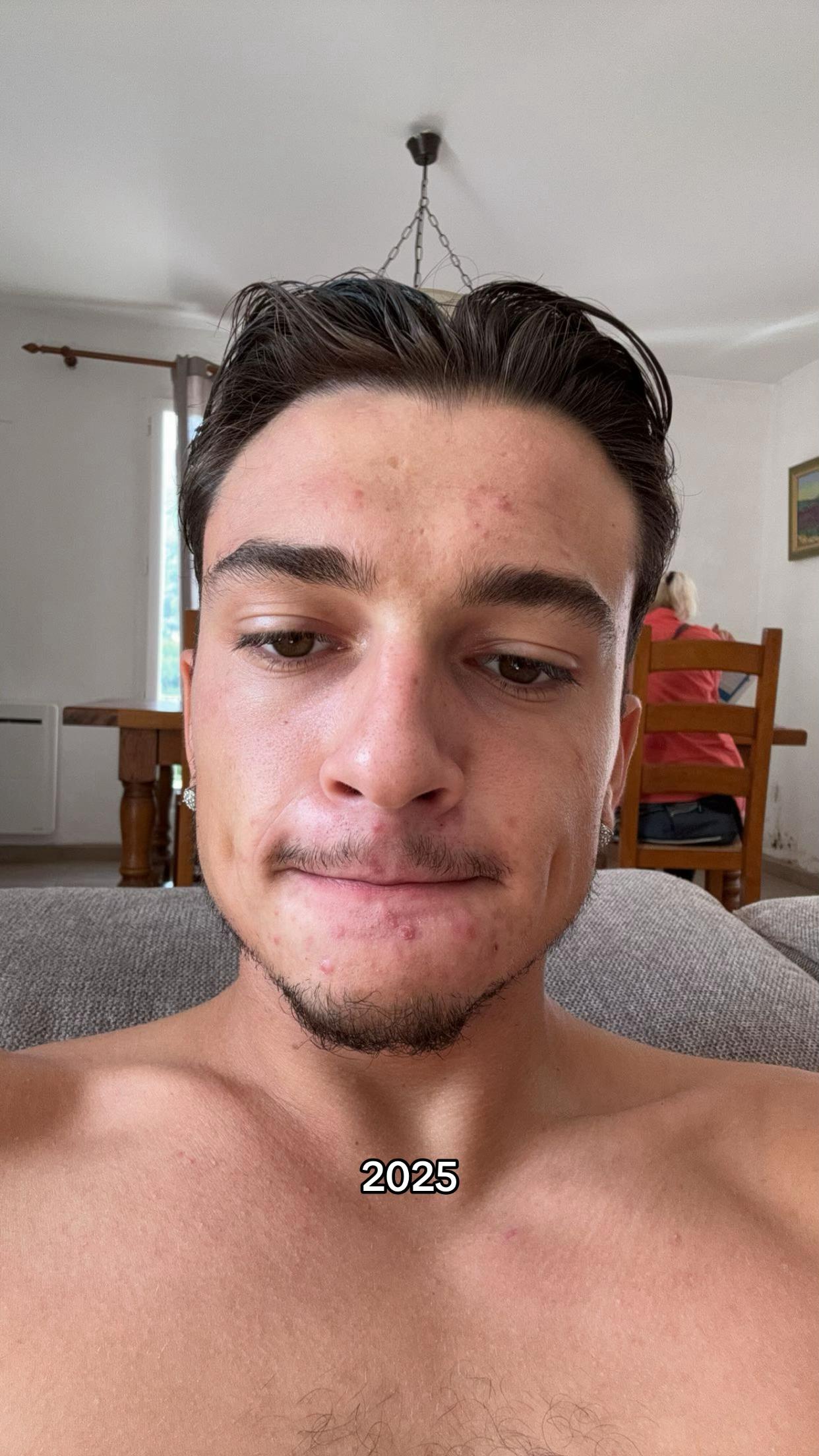 @Antoine