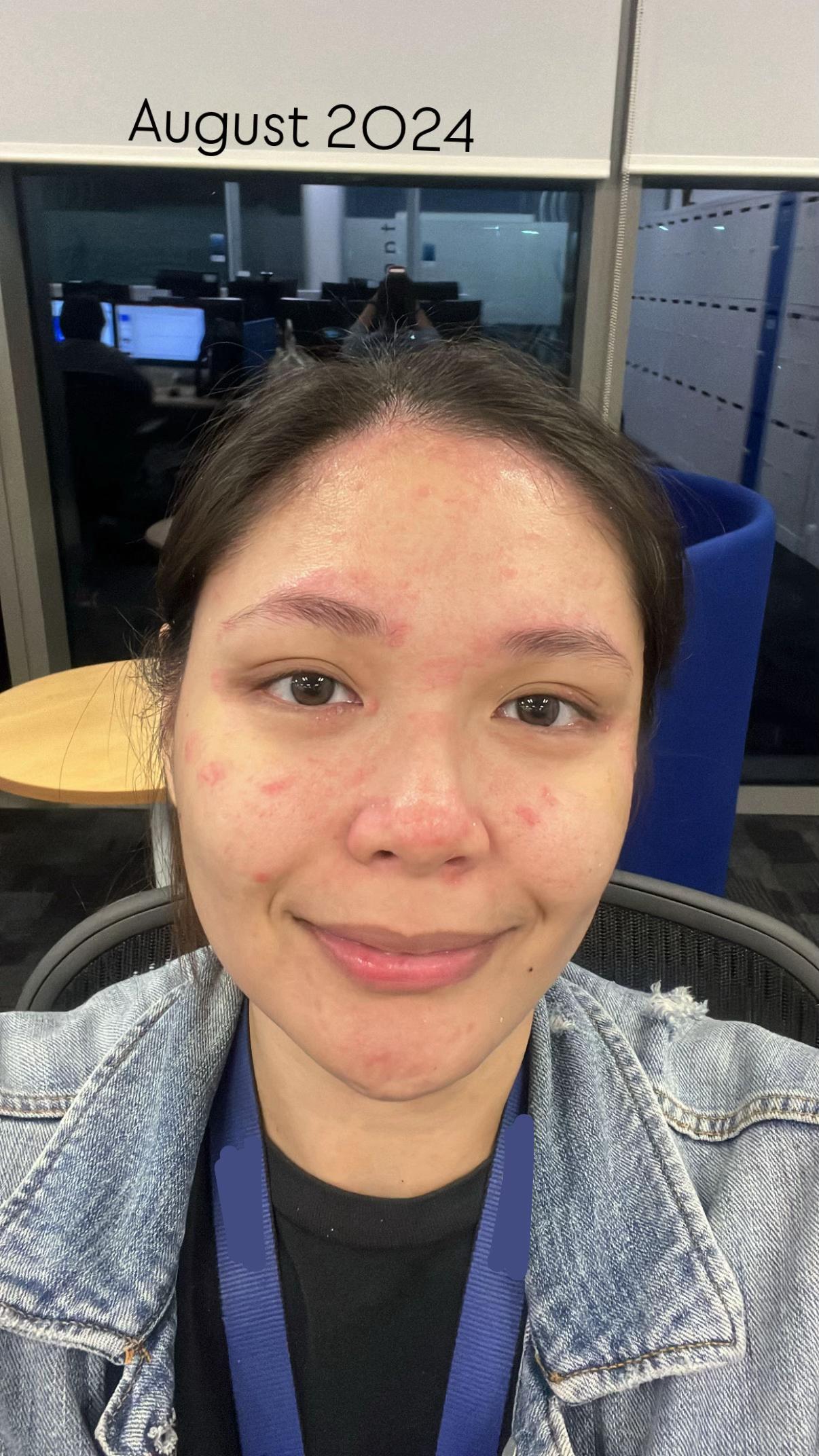 @alyanna santos