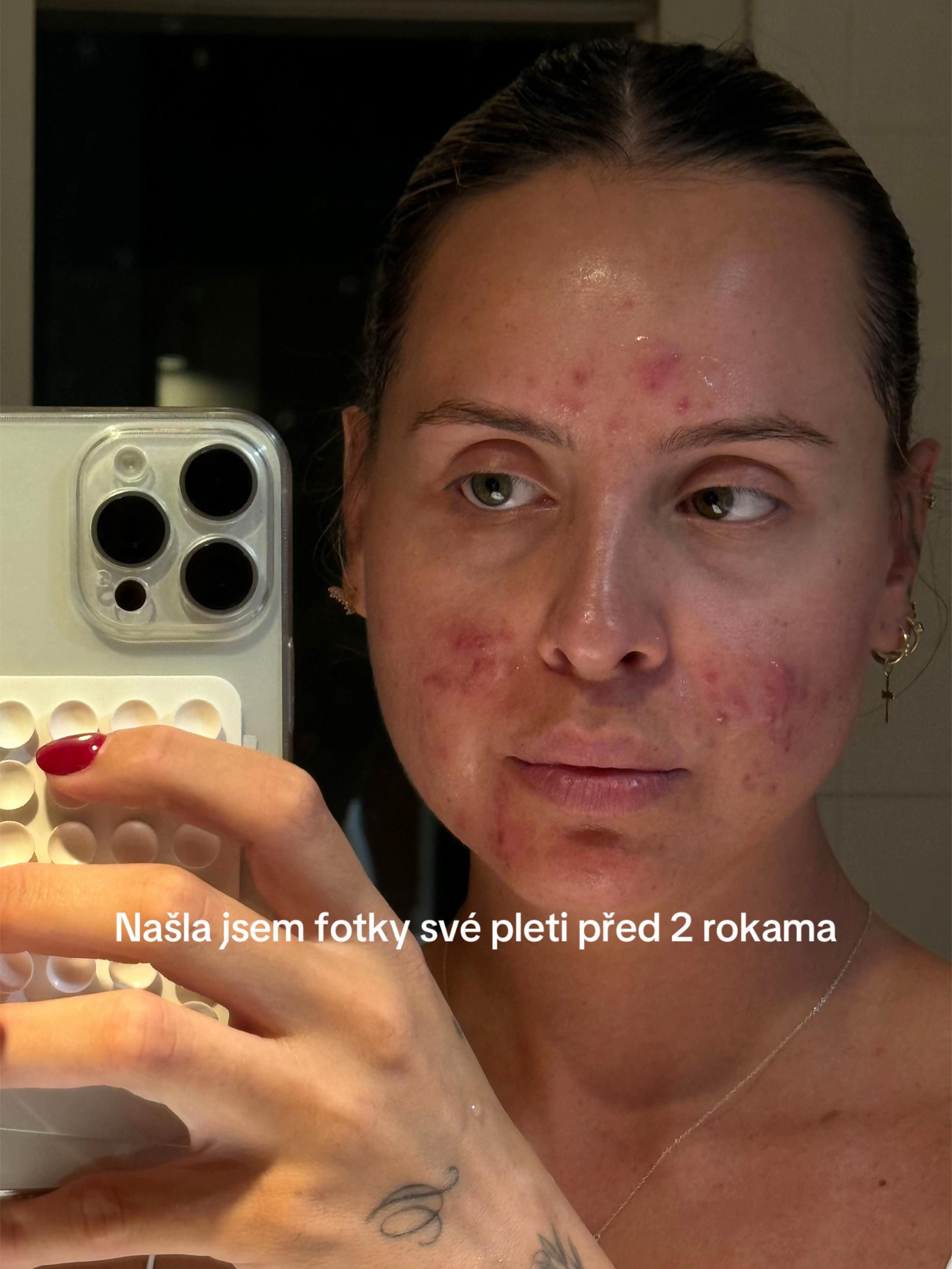 @SARA
