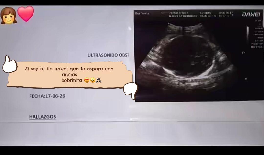 @ SR🎀🧸ྀིྀི