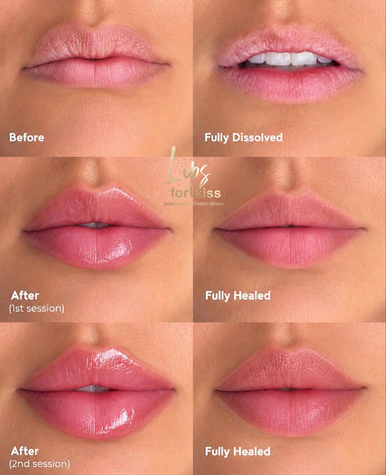 @Lips_for_kiss