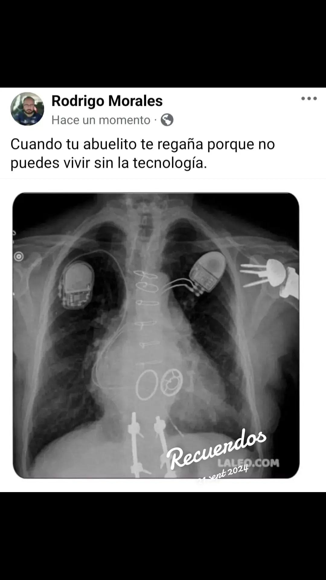 @Dr. Ajolote.