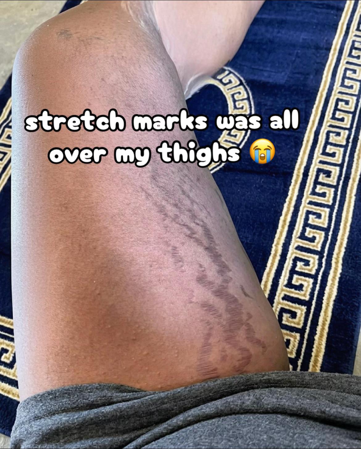 @Radiant skin