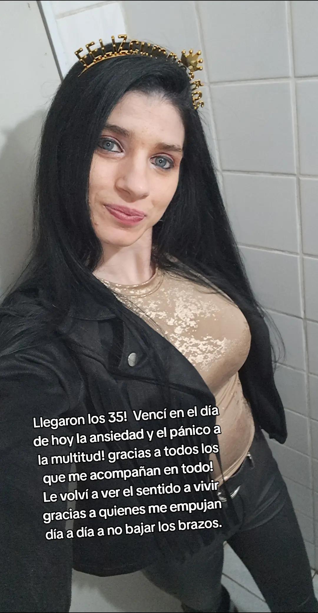 @Anii Dossena