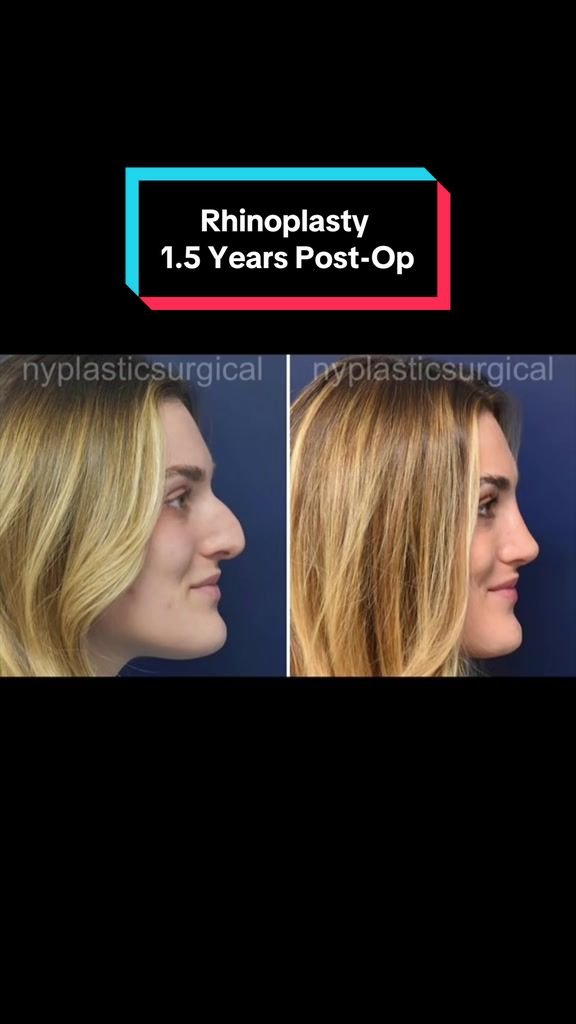 @Dr. Richard Reish, M.D., FACS