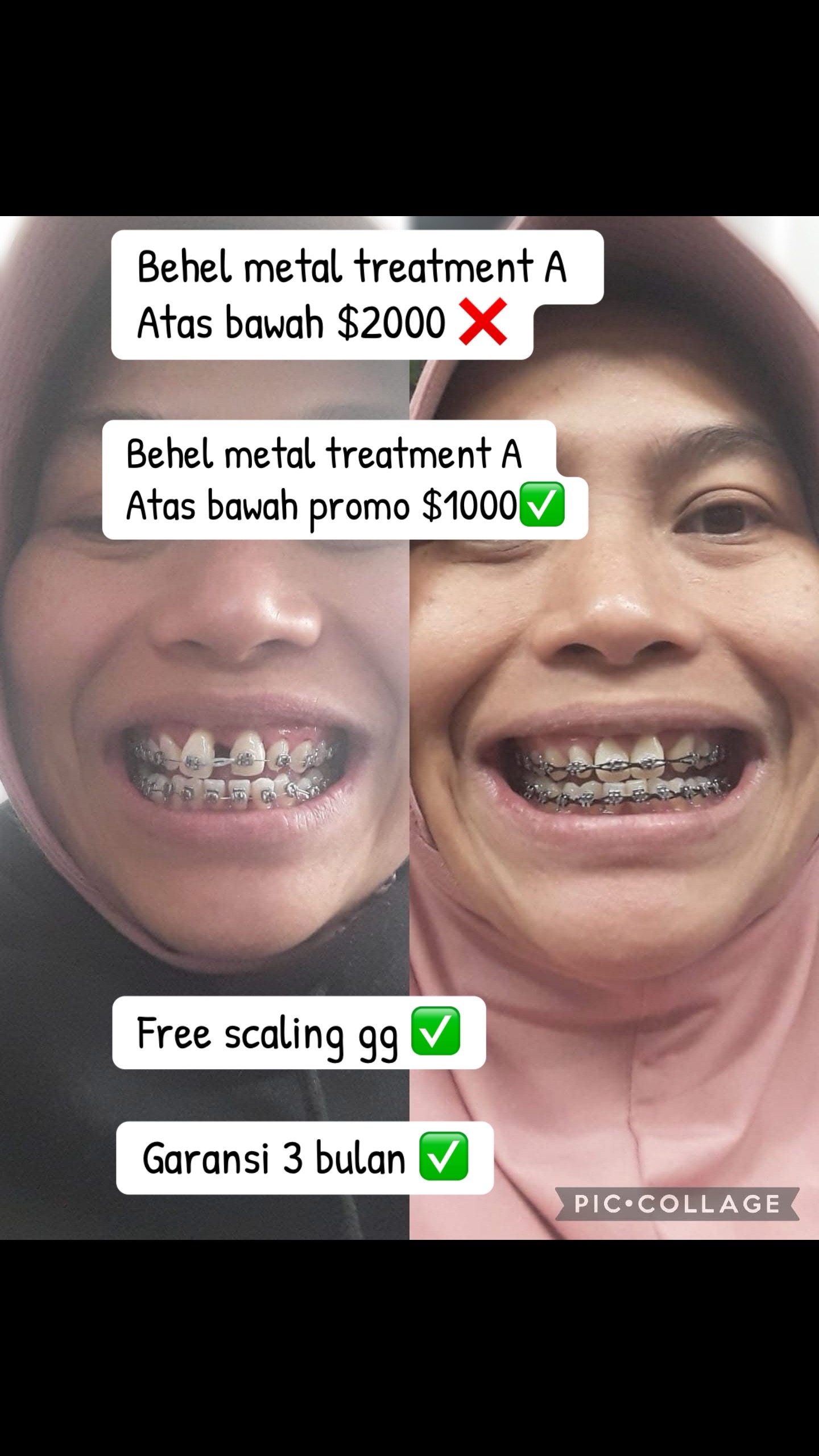 @mbak-Paijem