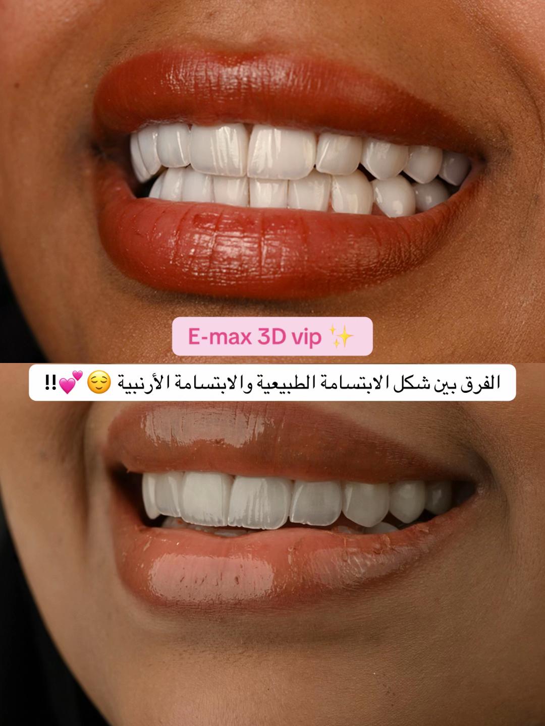 @Dr.lina_almasmoum