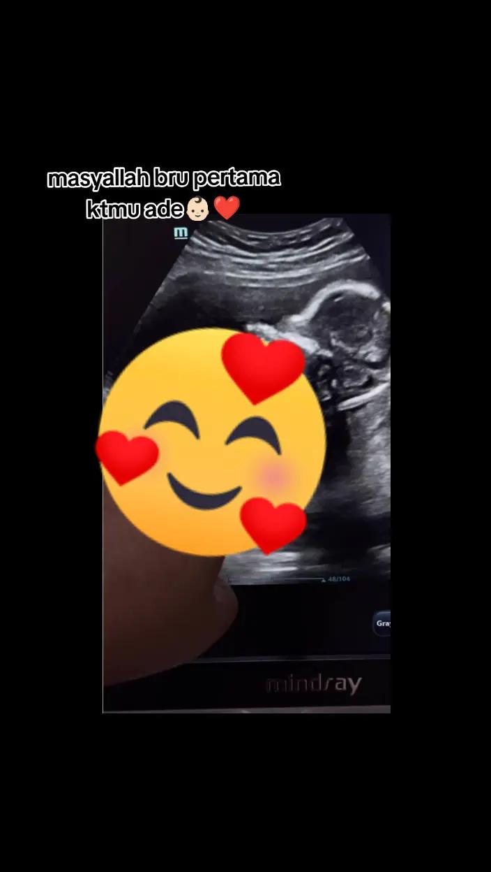 @Ichabondeng😁🥀