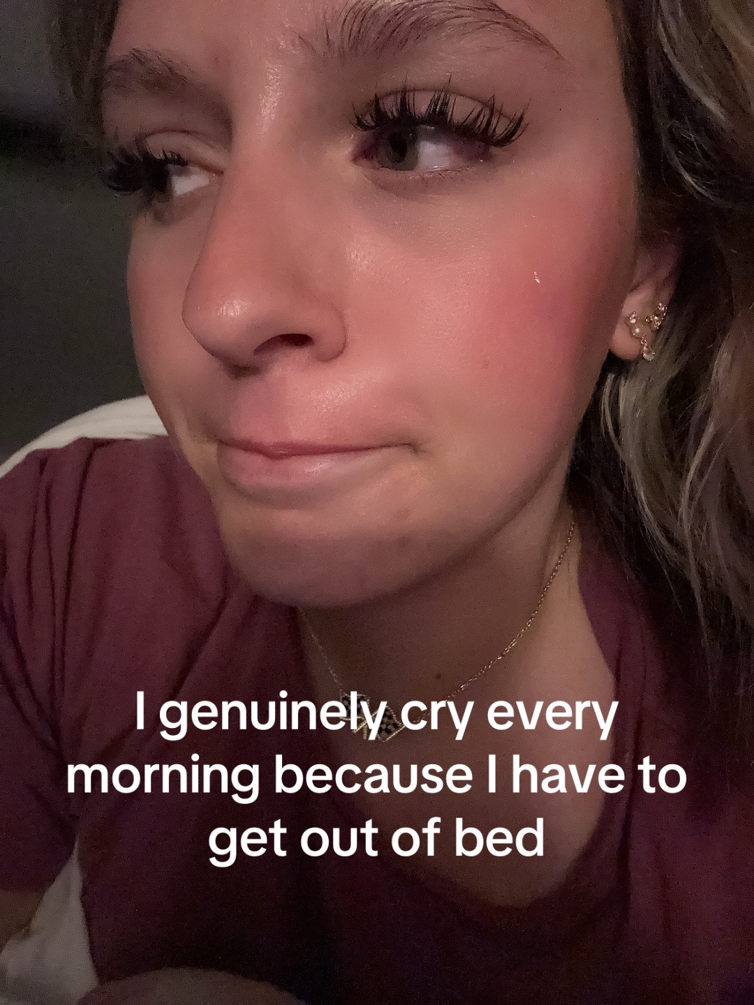 @Allysa