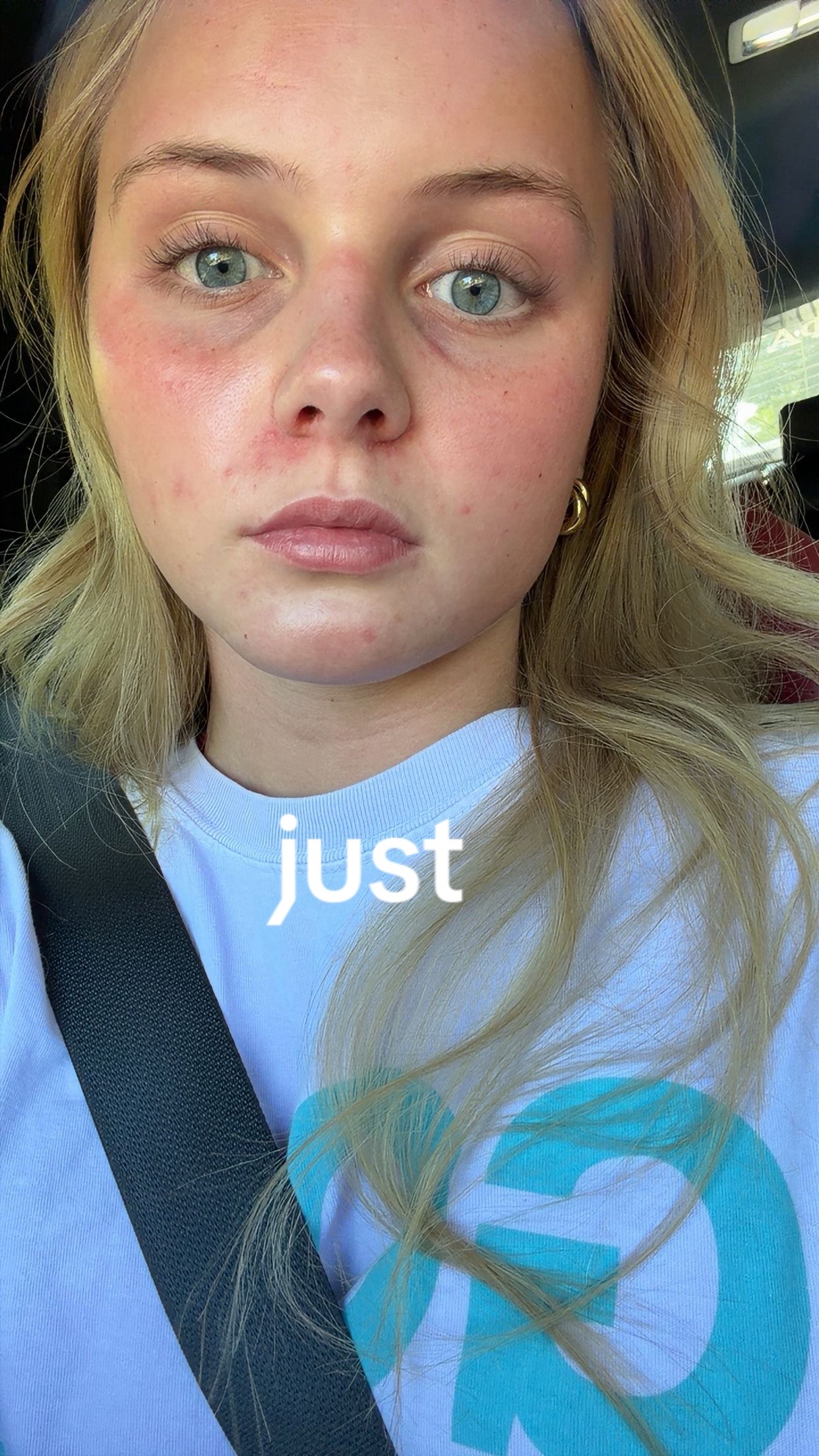 @Lilian