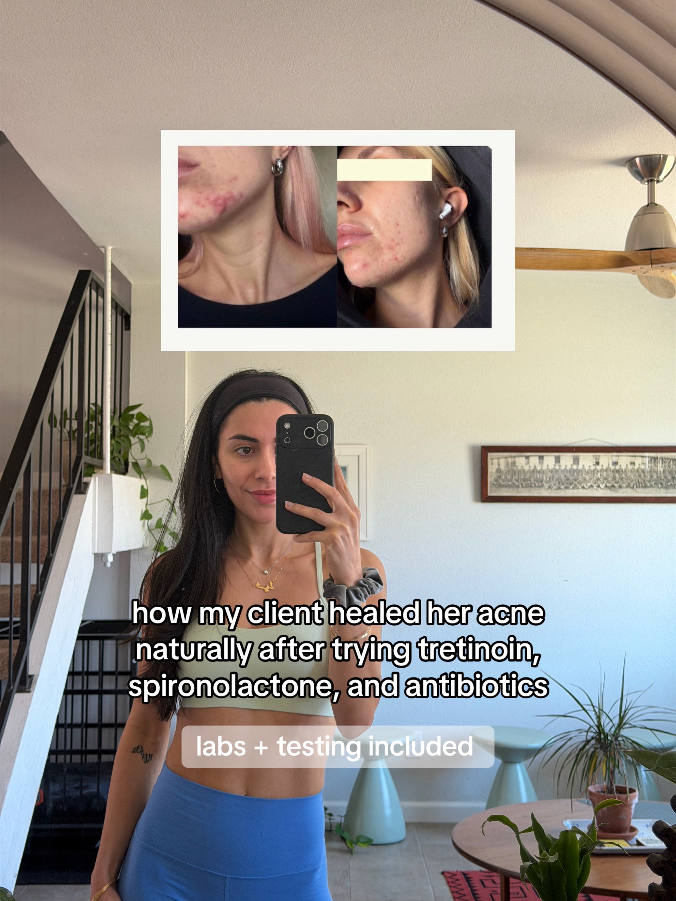 @Doctor Sheyda | Acne Expert