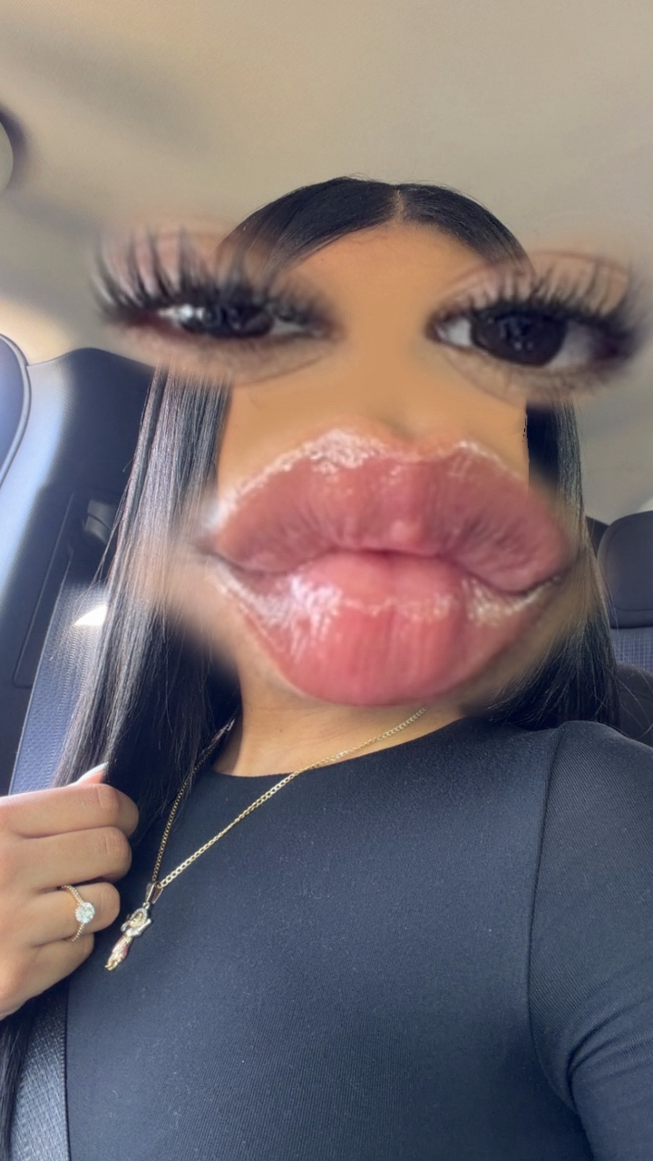 @NF