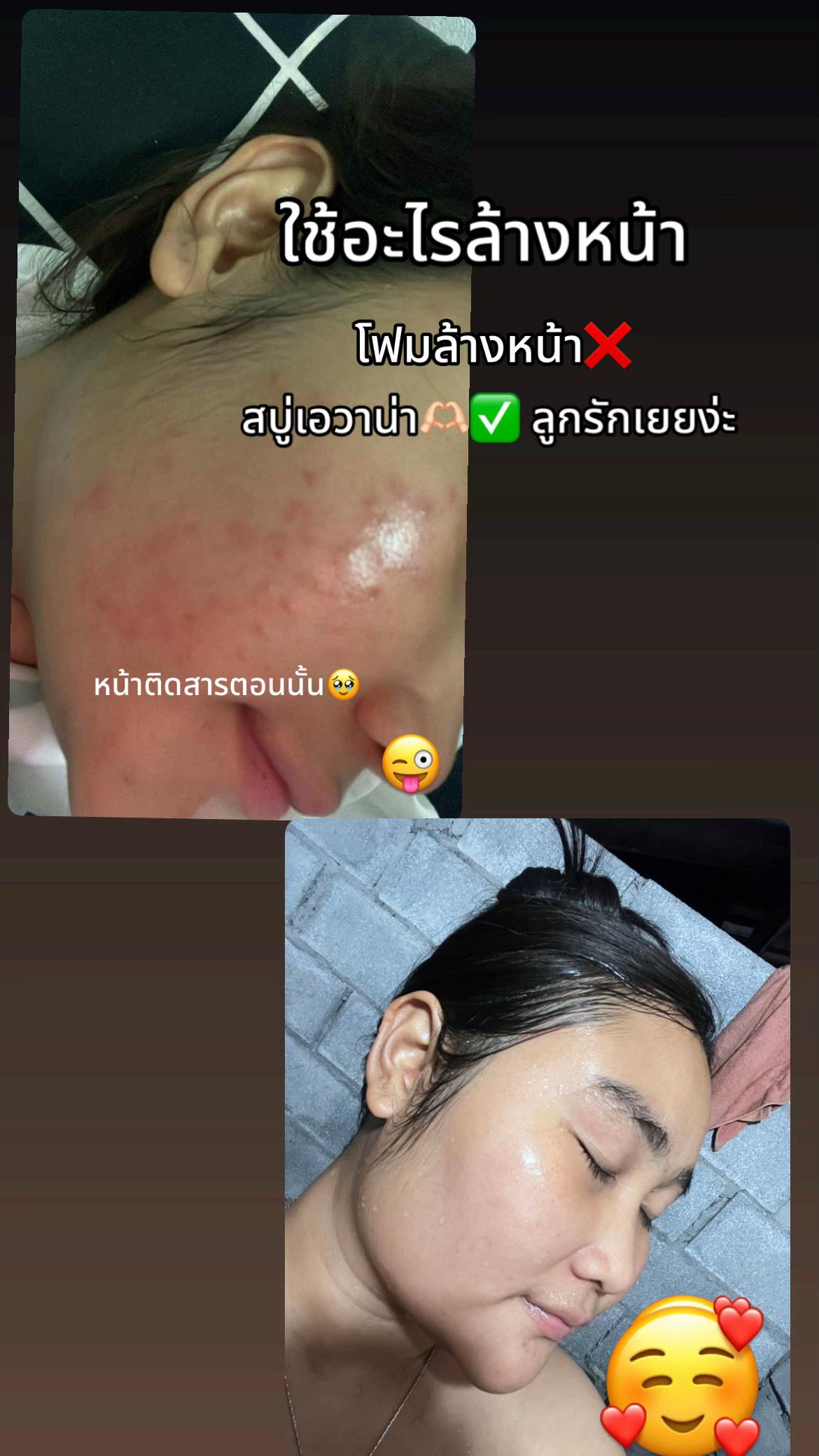 @เฟิร์นที่แก้มอ้วนๆ