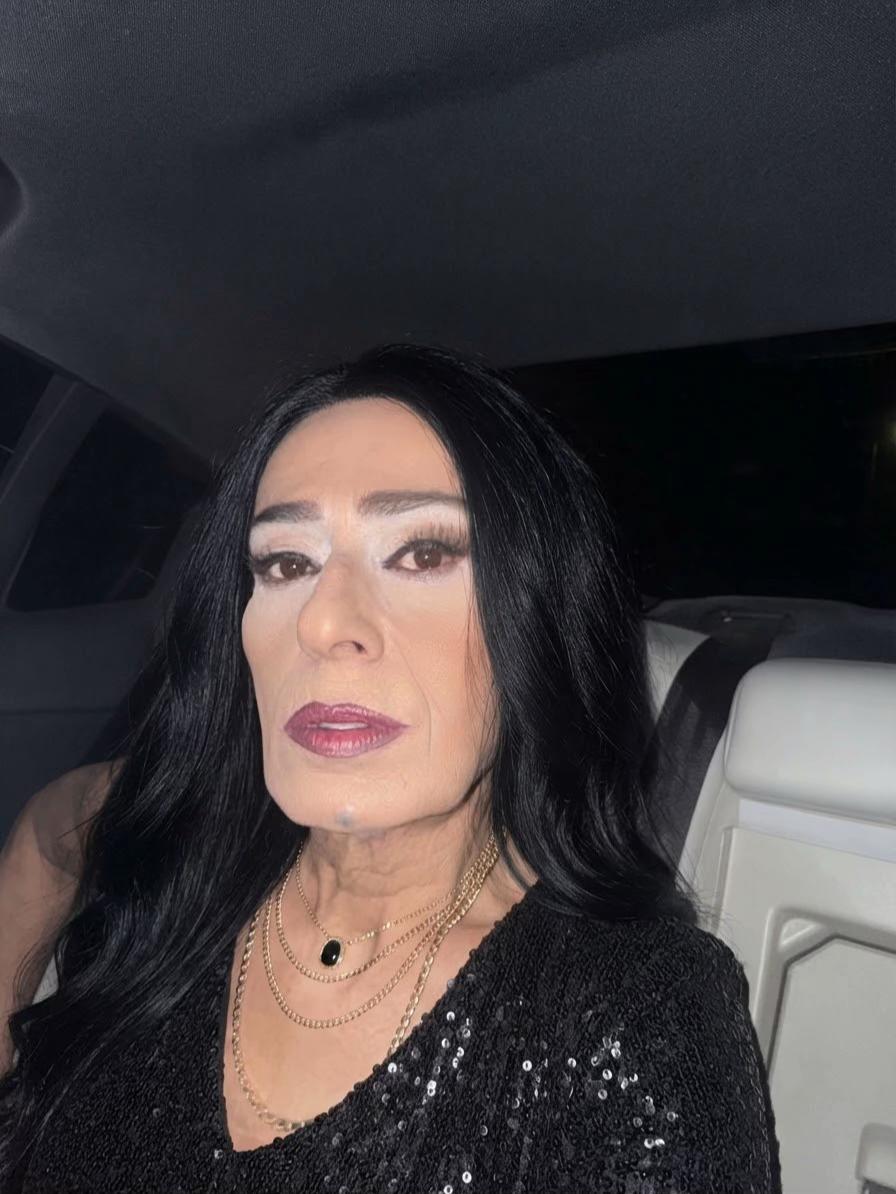 @Yıldız Tilbe
