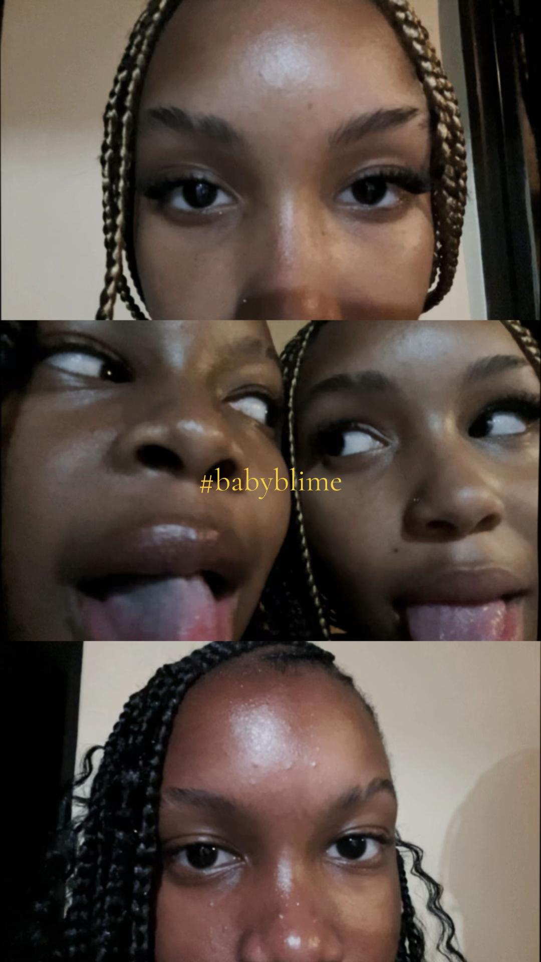 @Bipolar.
