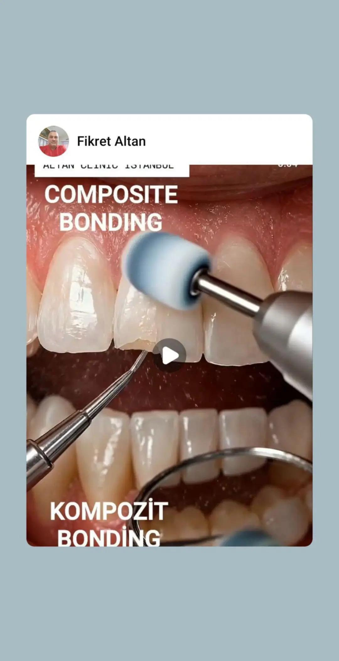 @DişHekimi Fikret Altan Dentist