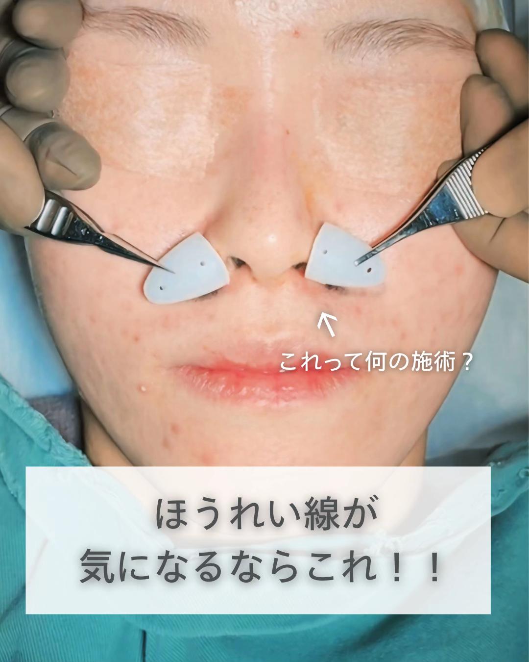 @鼻整形R Beauty CLINIC 副院長👨&zwj;⚕️吉田慧