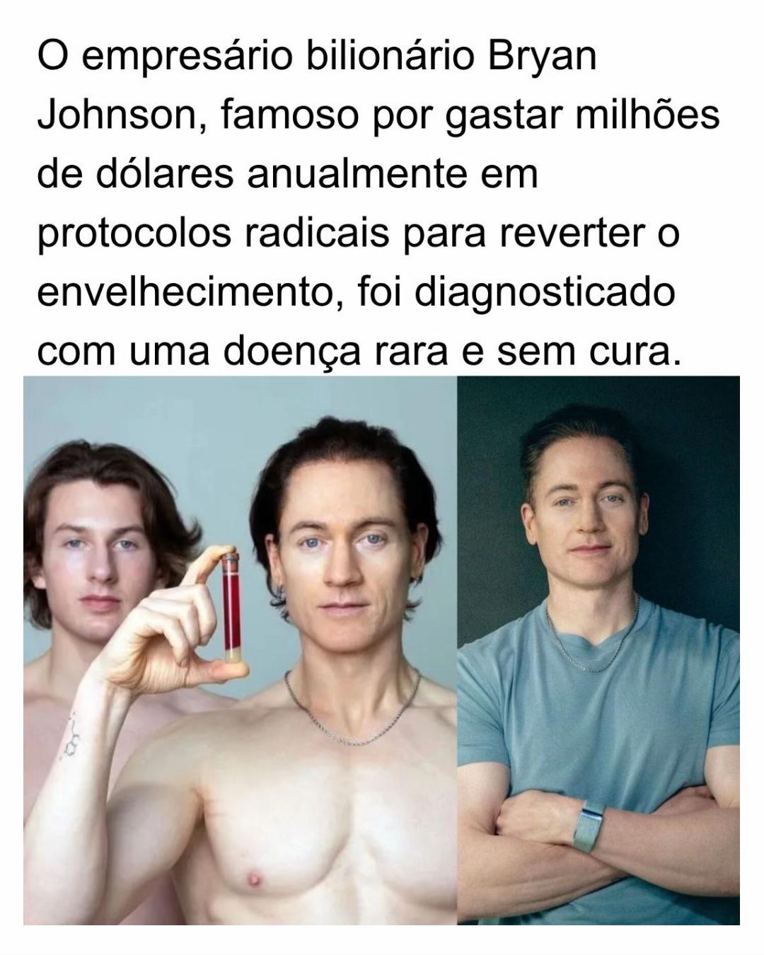 @Alfinetei