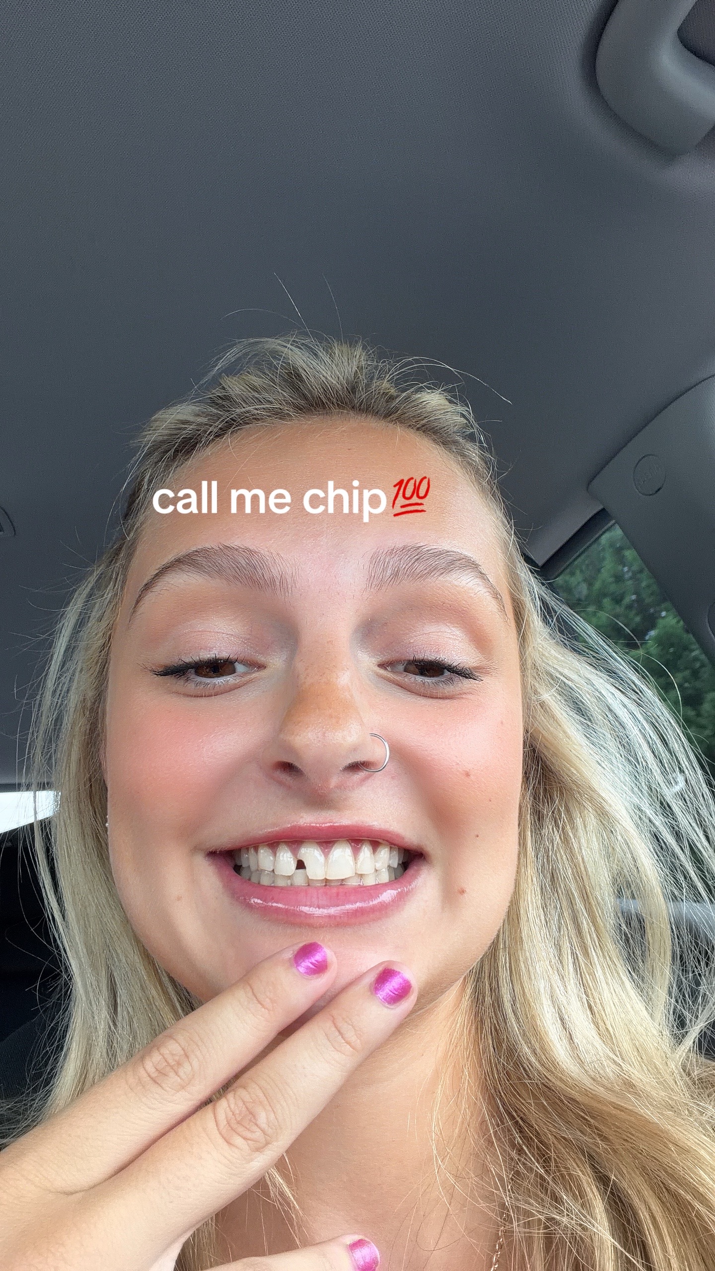 @alli